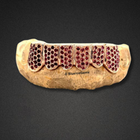 Iced Out Rose Gold Ruby Grillz