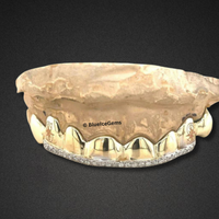 Polished Gold & Iced-Out Bar Grillz