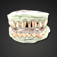 Rose Rail Solid Set Grillz