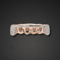 Rose Gold Diamond Bar Open-Face Grillz