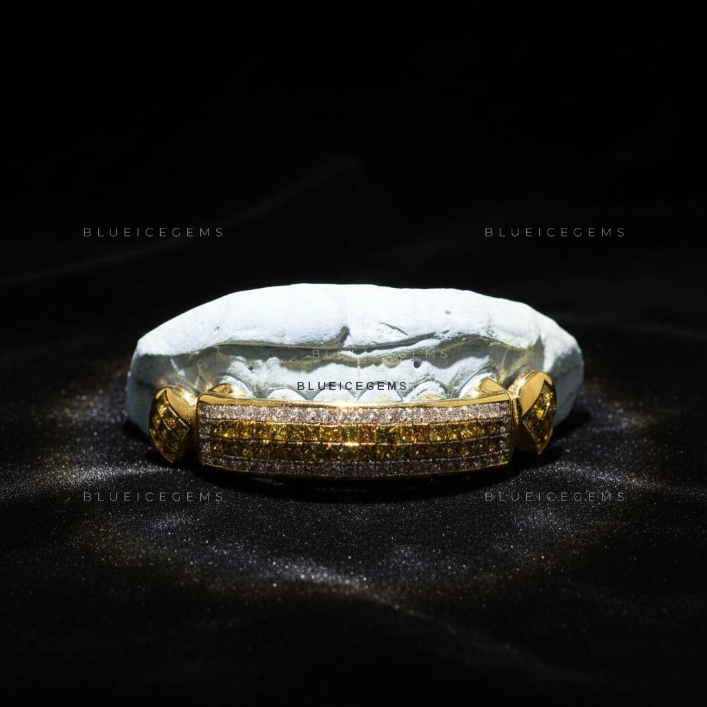 Gilded Canary & White Diamond Striped Bridge Grillz