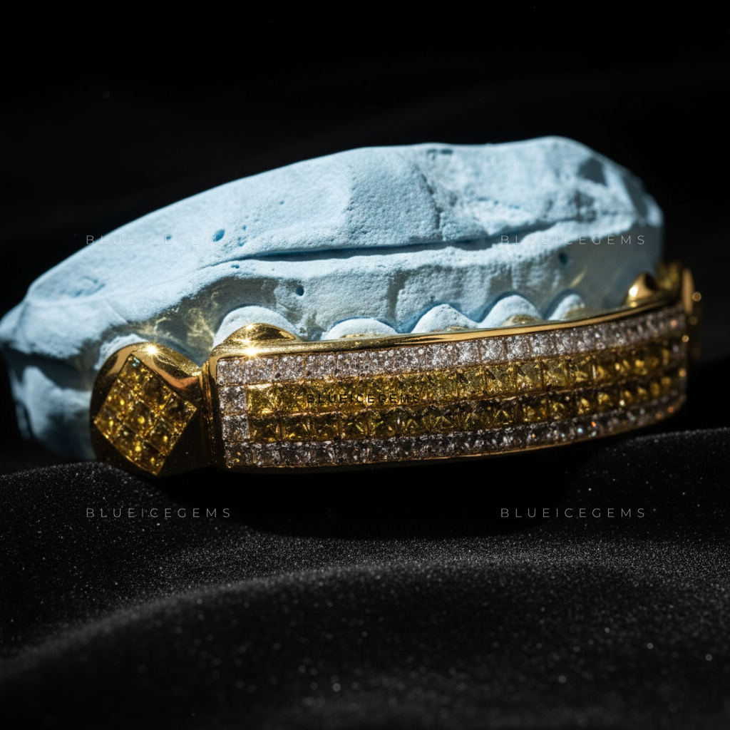 Gilded Canary & White Diamond Striped Bridge Grillz