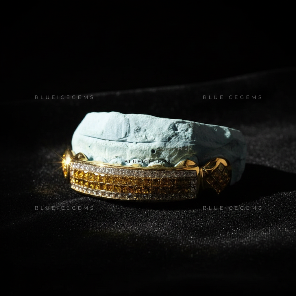 Gilded Canary & White Diamond Striped Bridge Grillz