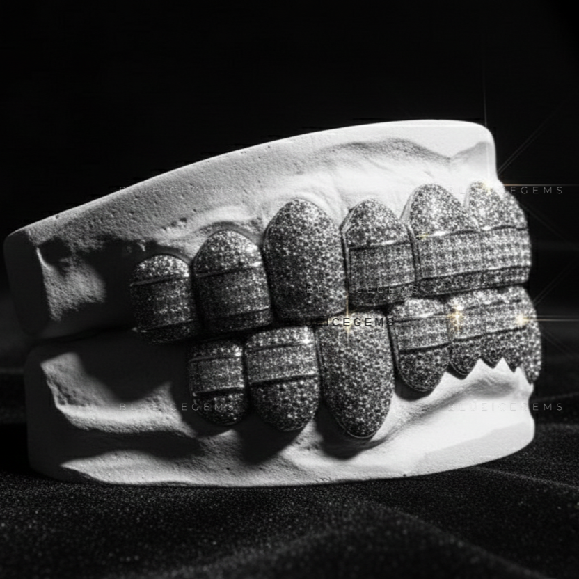 Diamond Belted Avalanche Full-Set Grillz