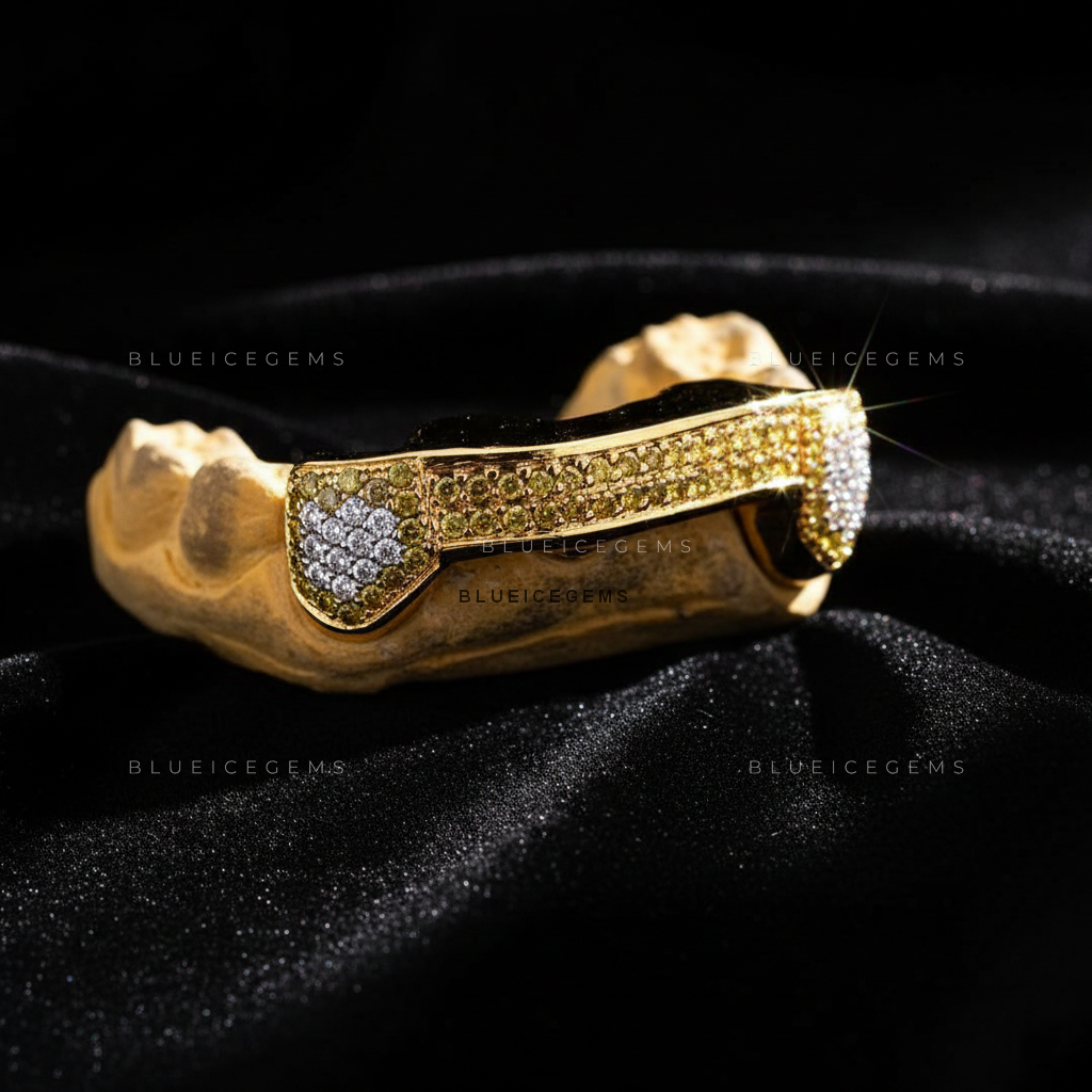 Canary & White Diamond Bridge Grillz