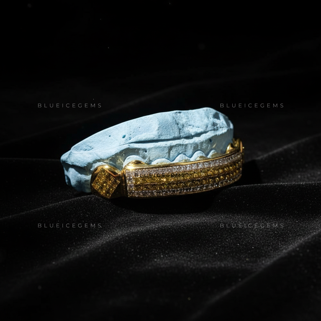 Gilded Canary & White Diamond Striped Bridge Grillz