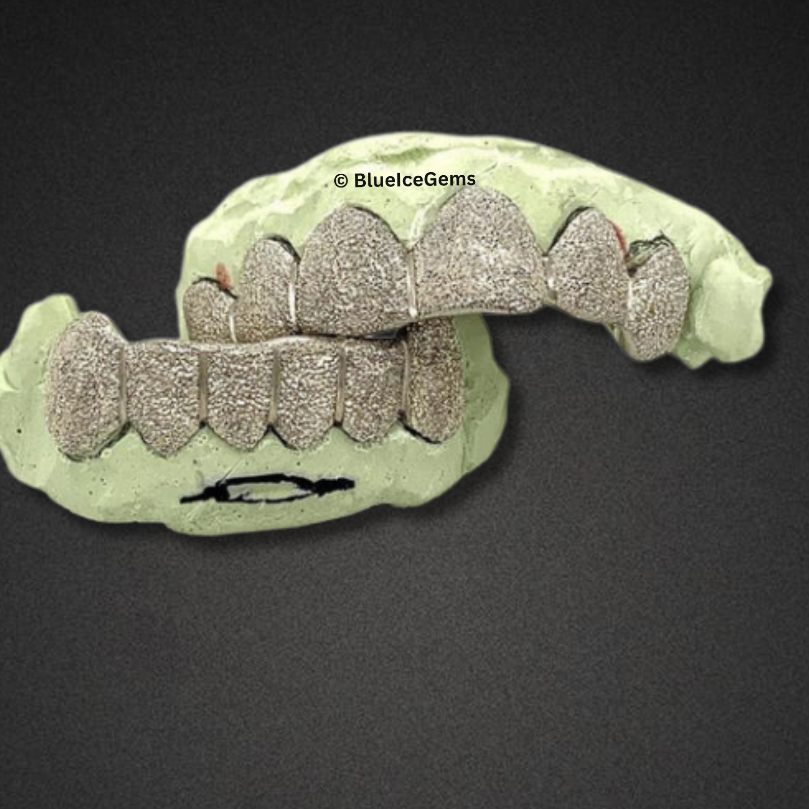 Frostfall Diamond-Dust Full Set Grillz