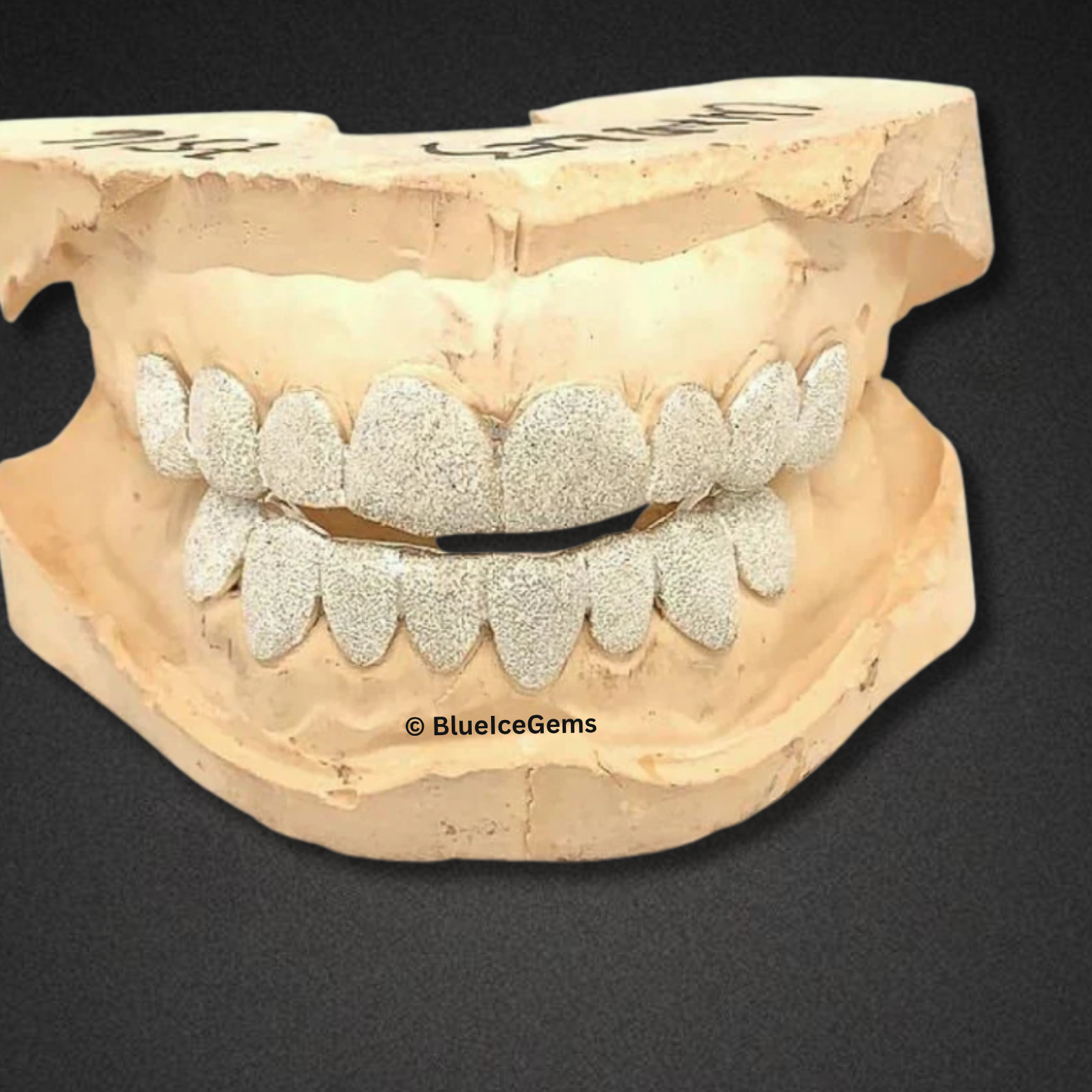 Frost Atlas Diamond‑Dust Grillz