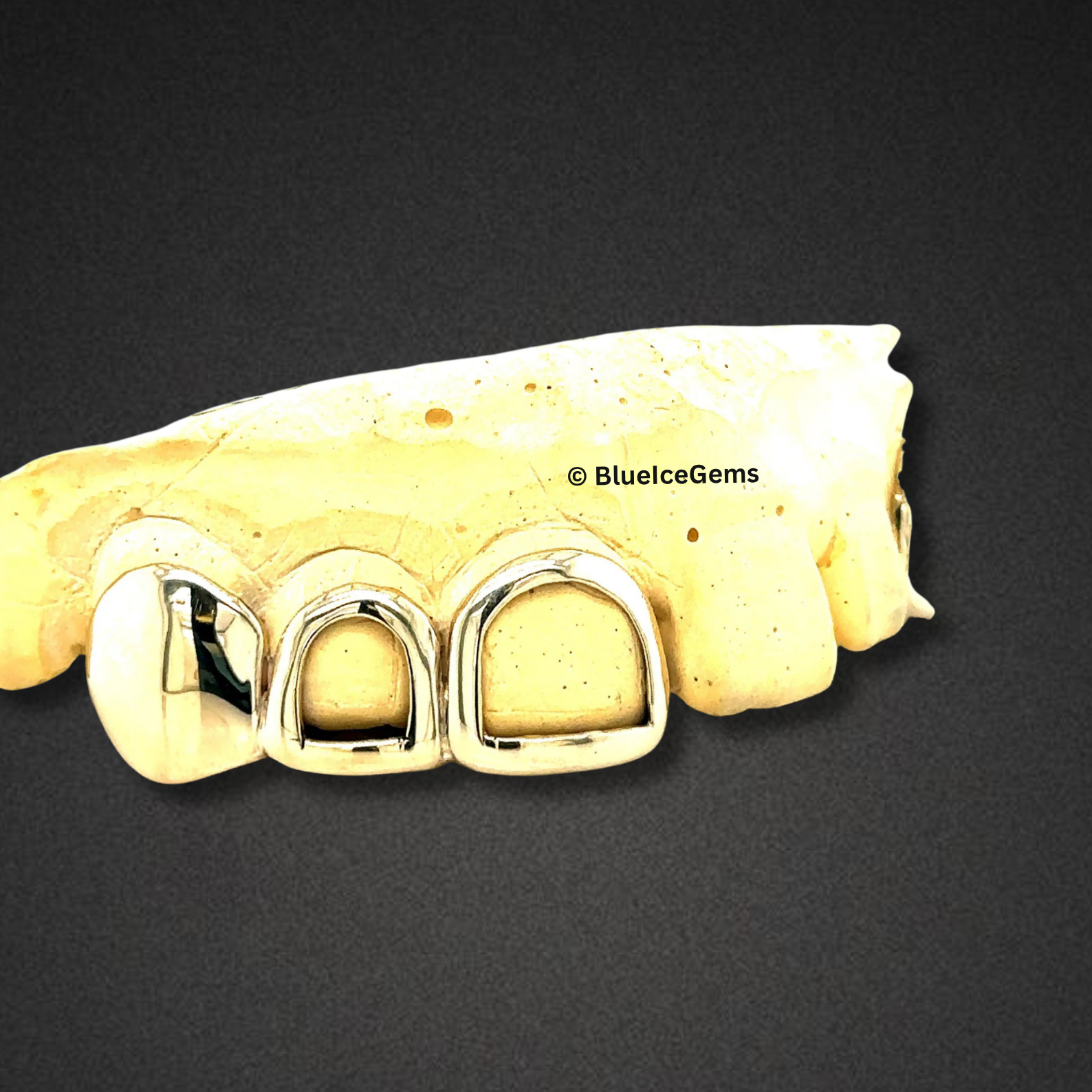 Classic Window Open Grillz