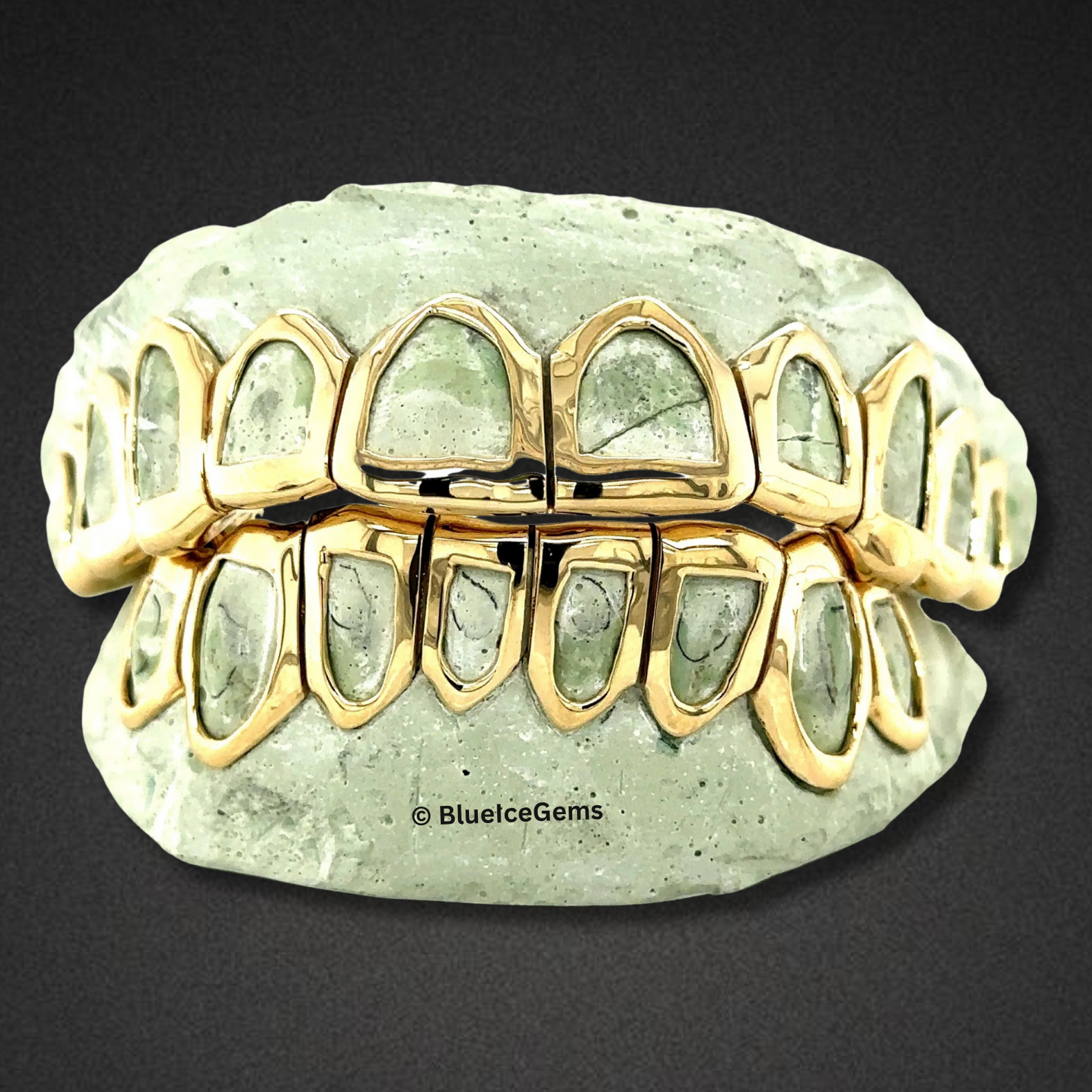 Iconic Gold Open-Face Grillz