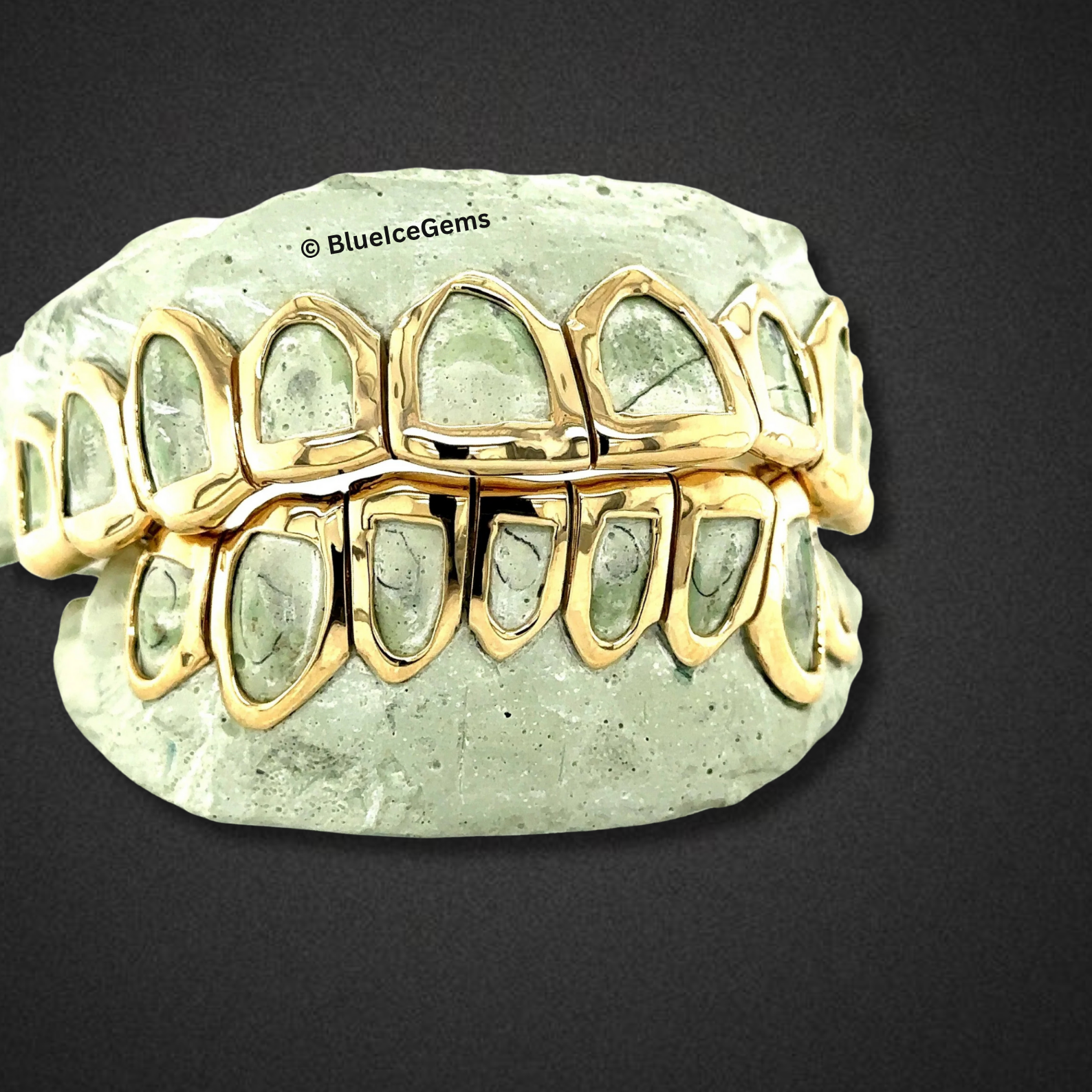 Iconic Gold Open-Face Grillz