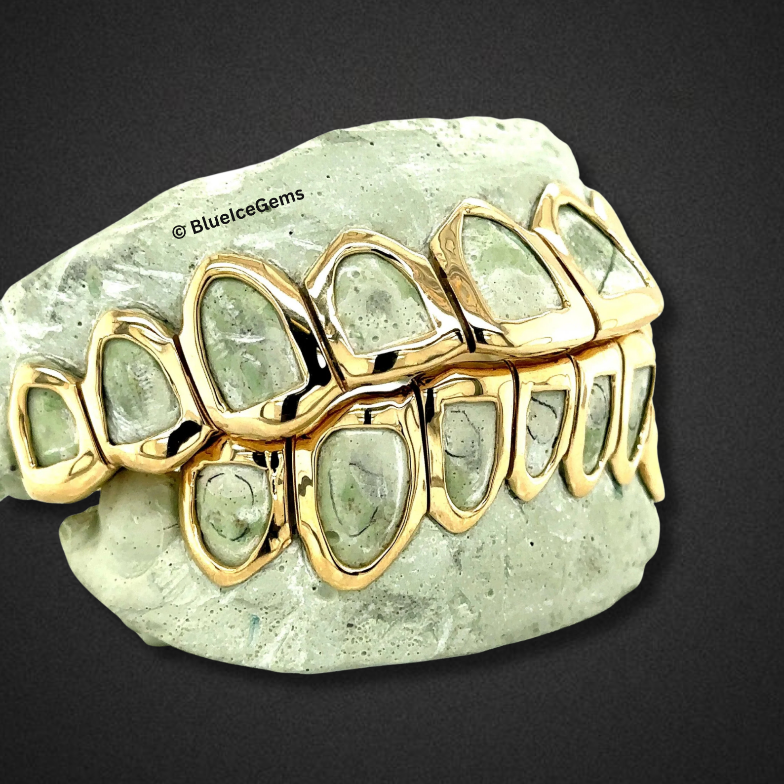 Iconic Gold Open-Face Grillz