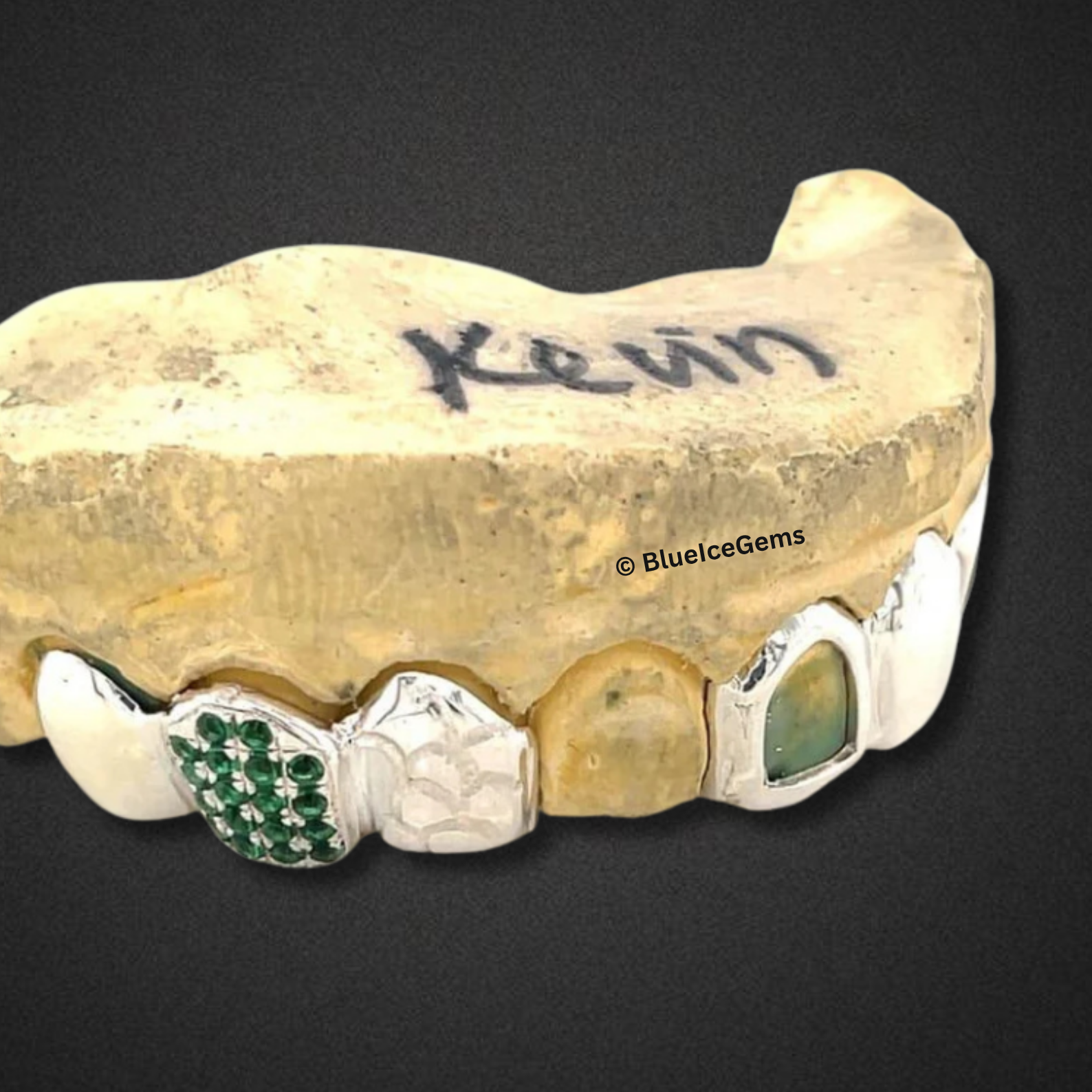 "The Kevin" Custom Emerald Grillz