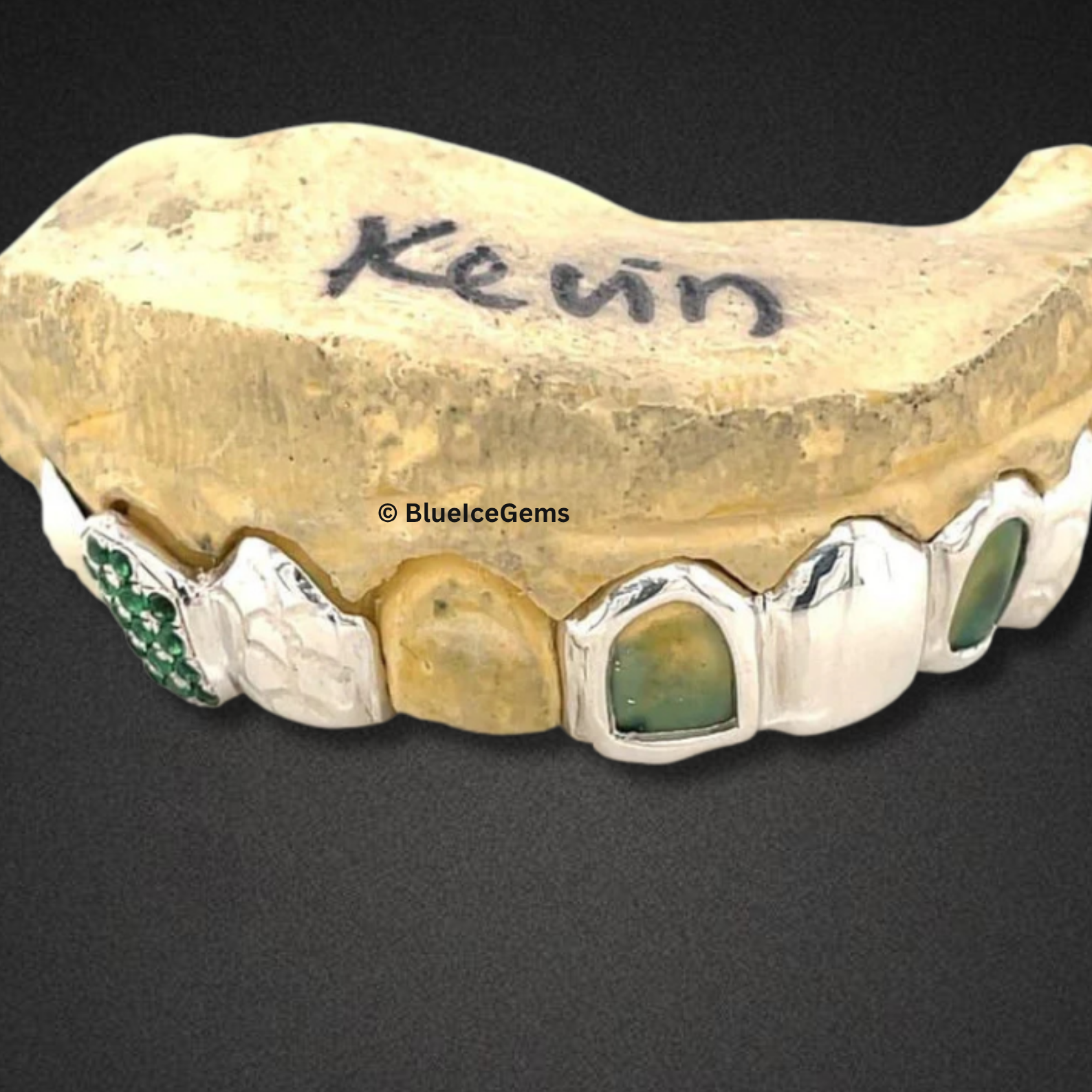 "The Kevin" Custom Emerald Grillz