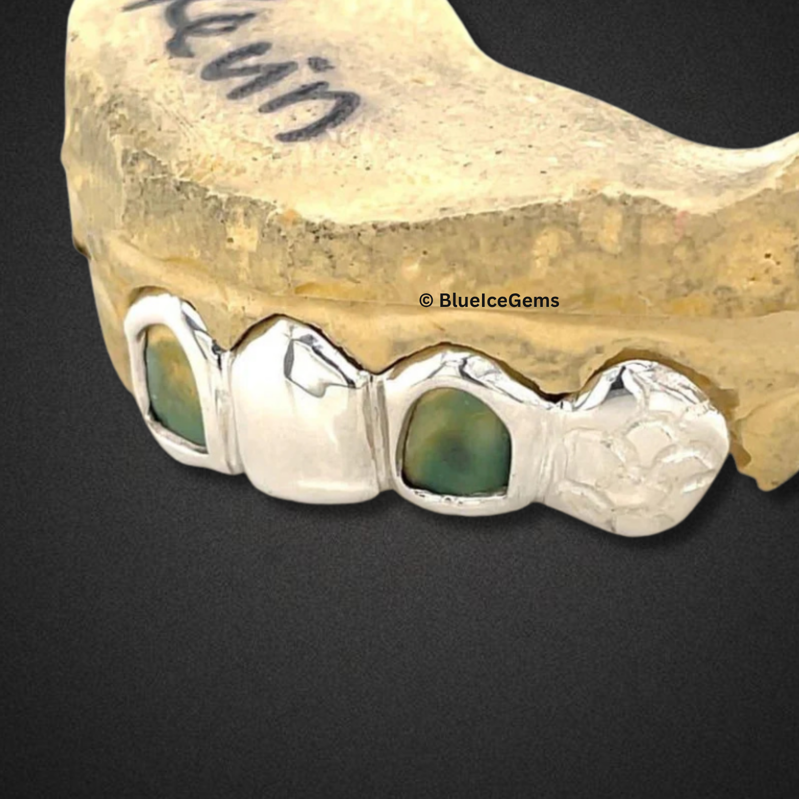 "The Kevin" Custom Emerald Grillz