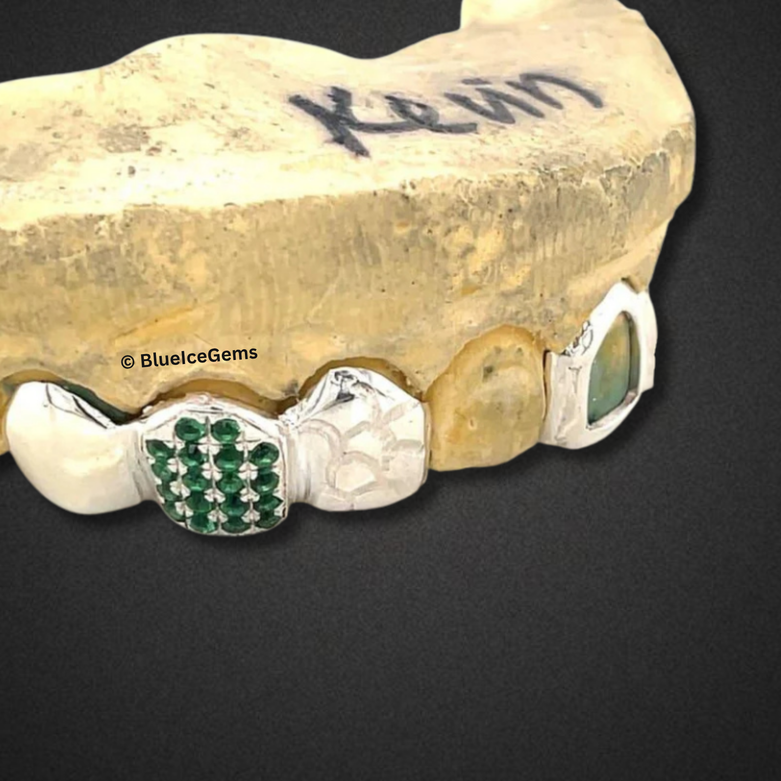 "The Kevin" Custom Emerald Grillz