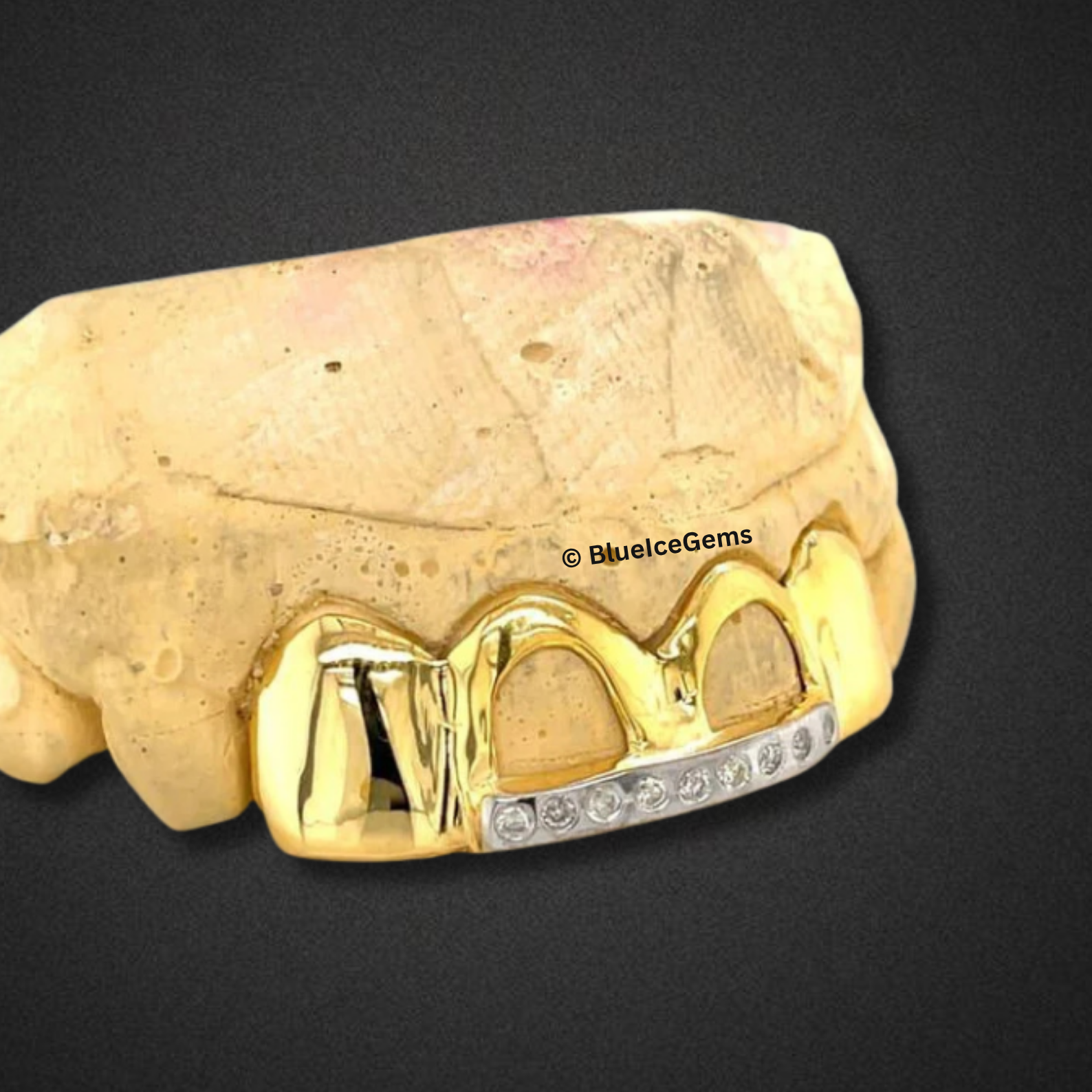 "Money Bag" Gold and Diamond Grillz
