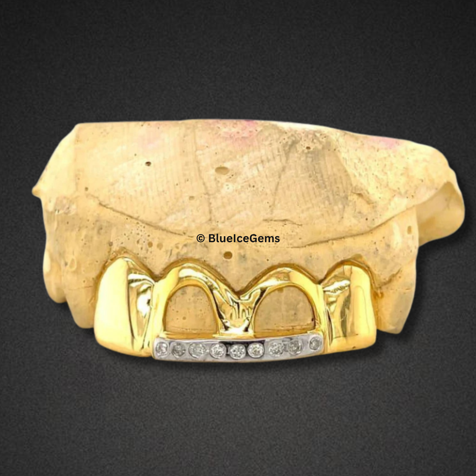 "Money Bag" Gold and Diamond Grillz