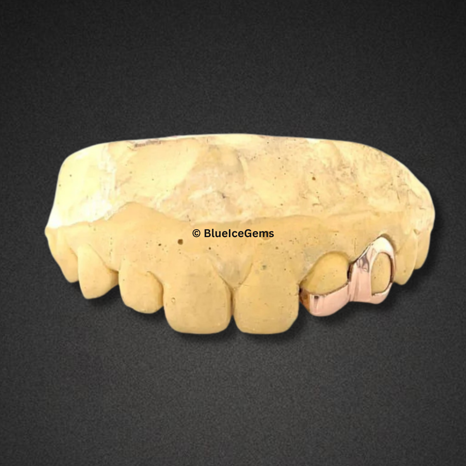 Open Face Rose Gold Cap Grillz