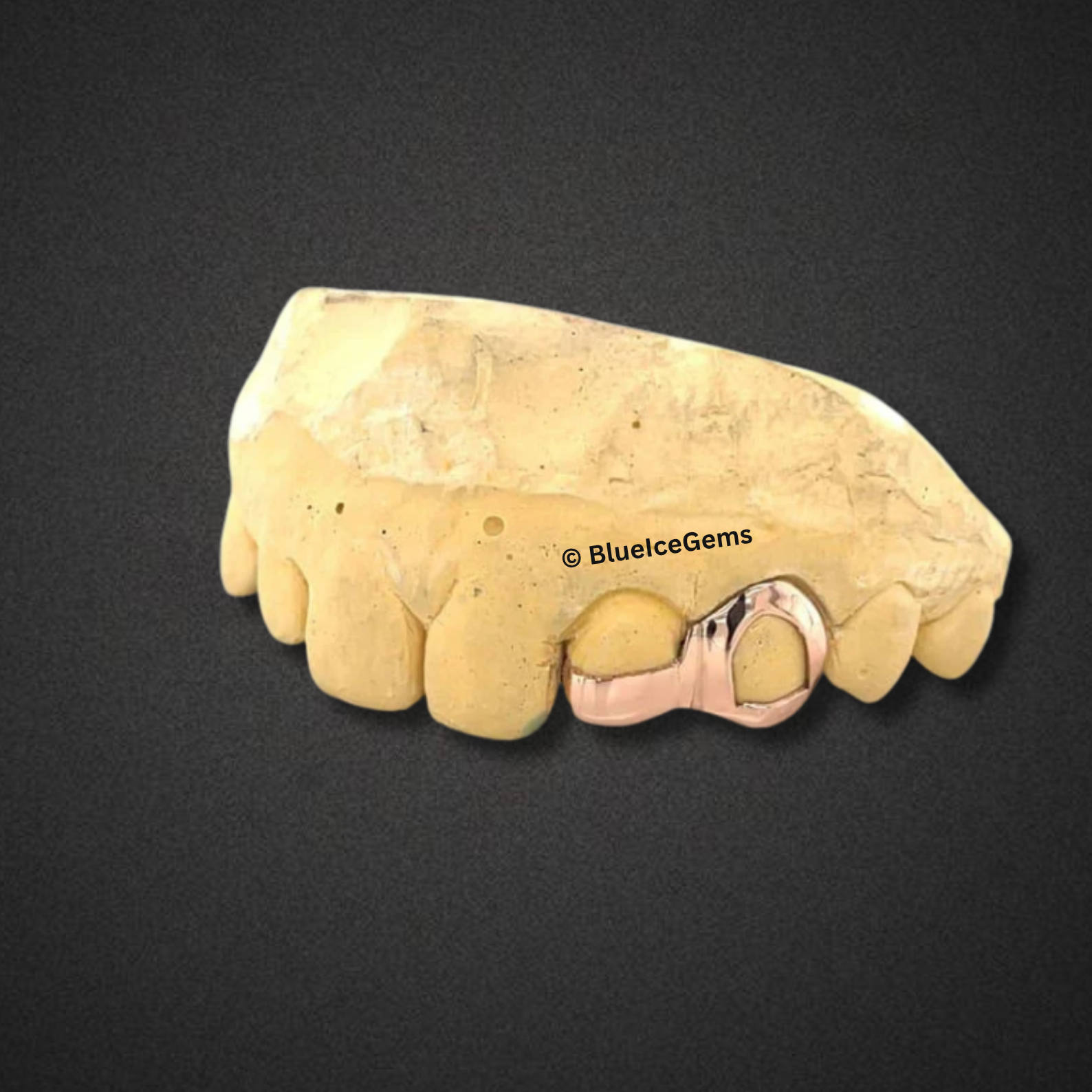 Open Face Rose Gold Cap Grillz
