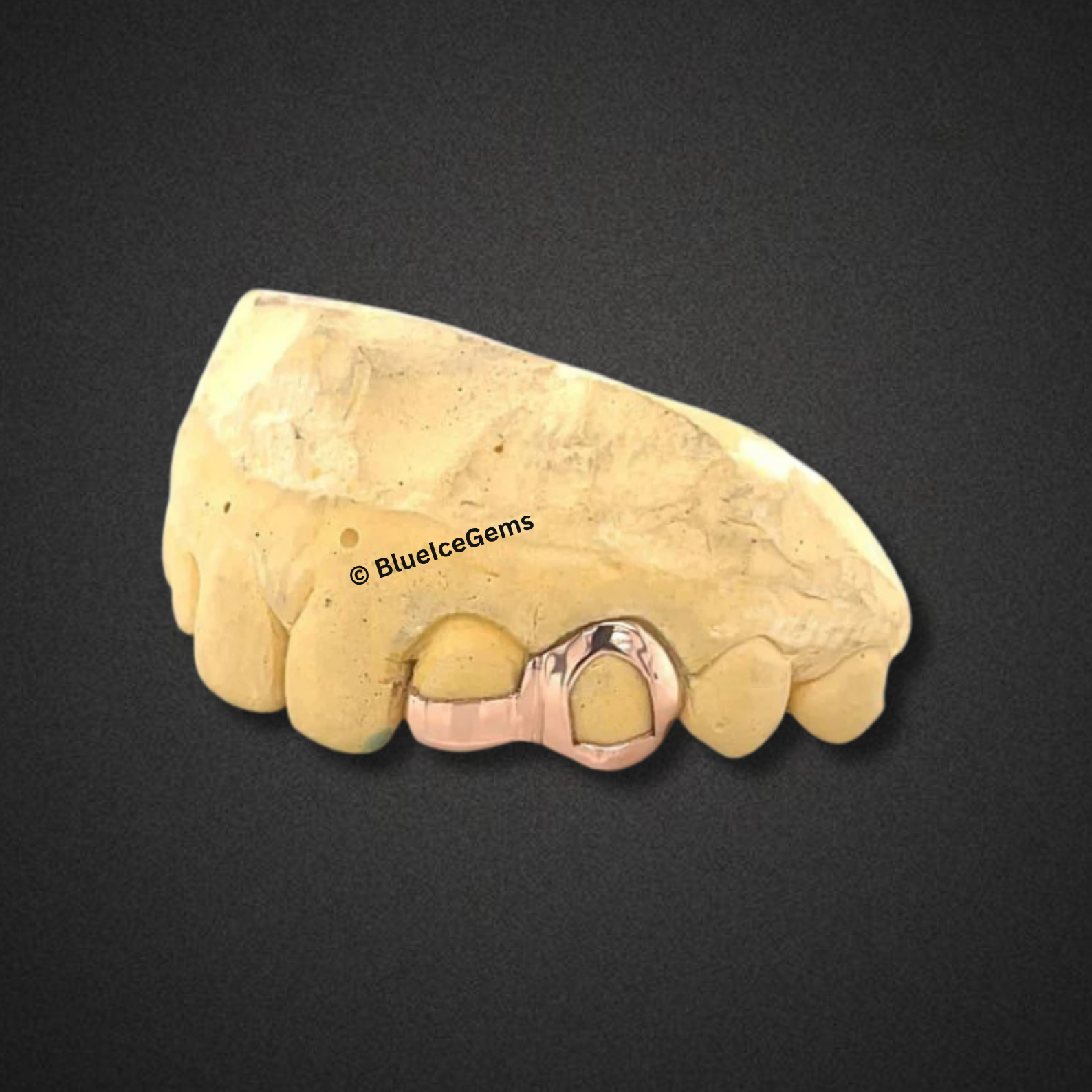 Open Face Rose Gold Cap Grillz