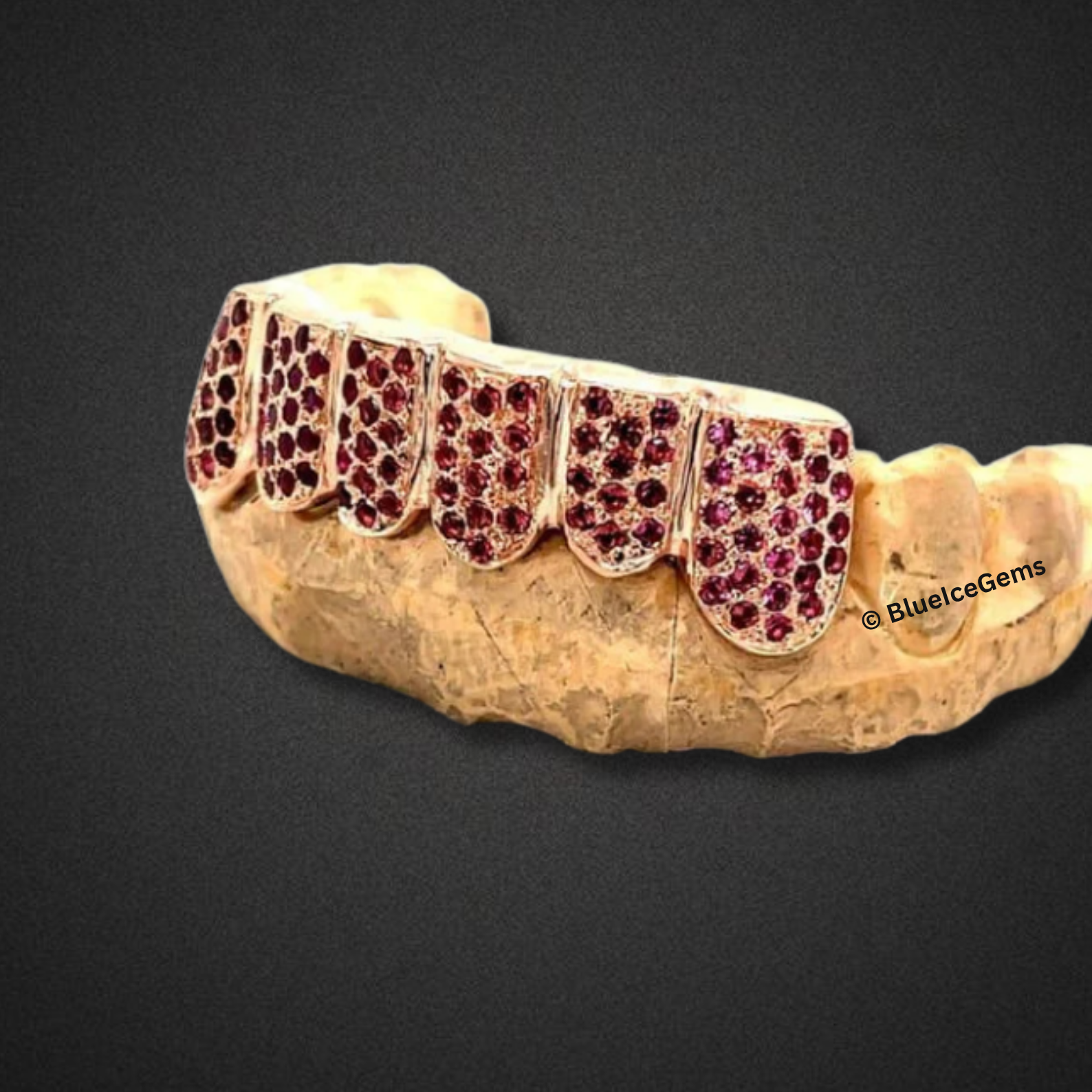 Iced Out Rose Gold Ruby Grillz