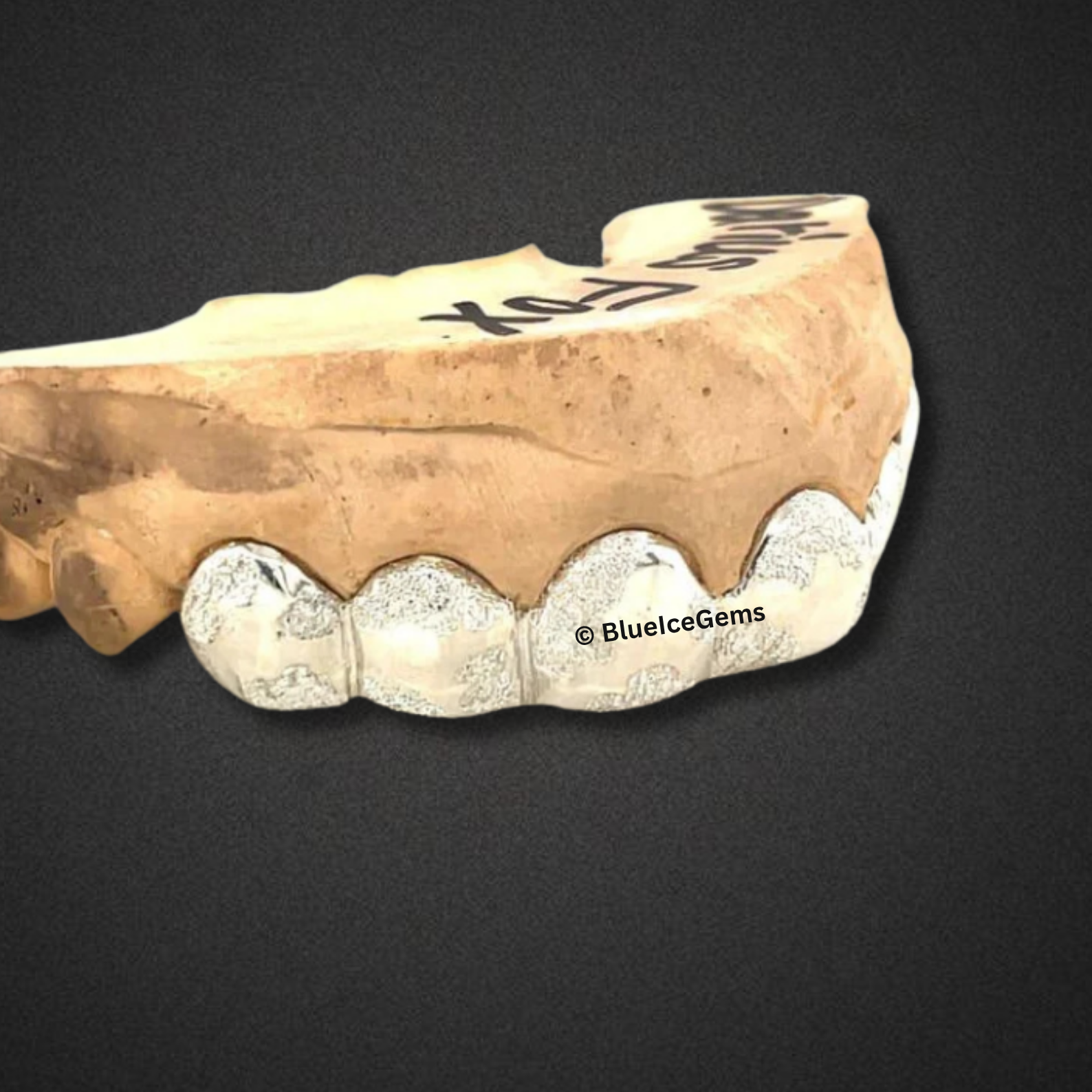 Diamond Dust White Gold Grillz