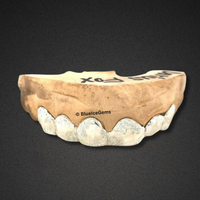 Diamond Dust White Gold Grillz
