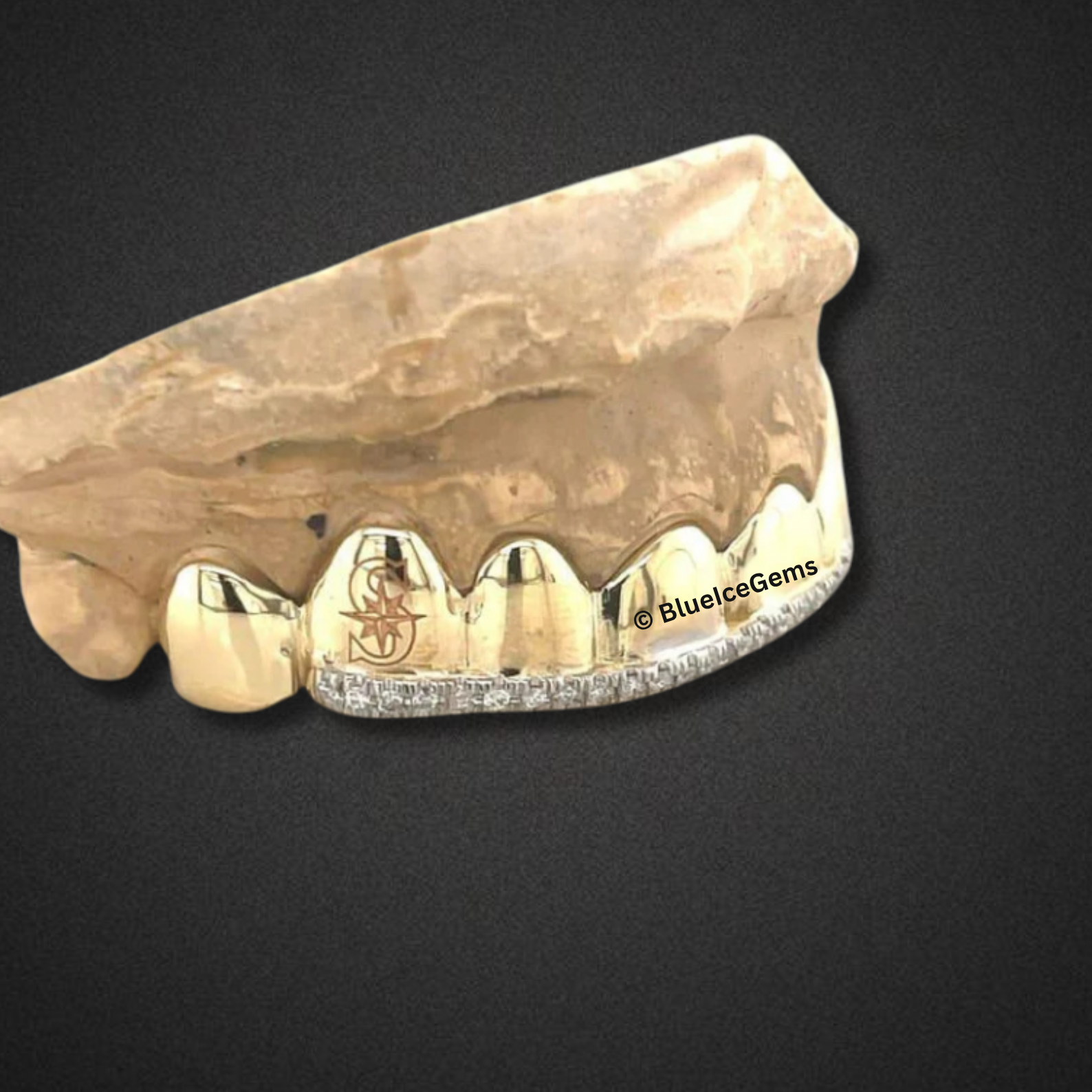 Polished Gold & Iced-Out Bar Grillz