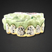 Royal Burst Diamond-Cut Gold Grillz