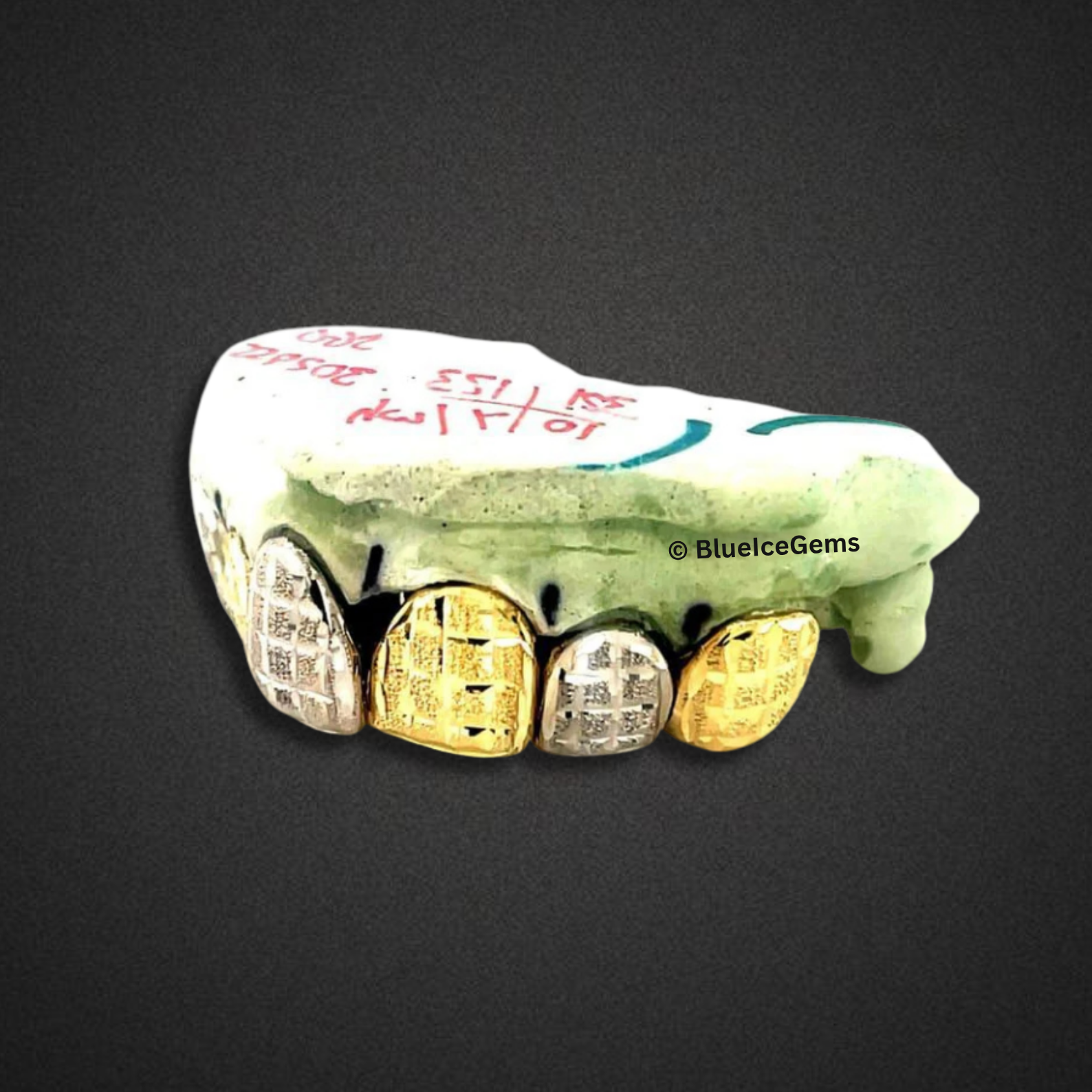 Checker Frost Two‑Tone Grillz