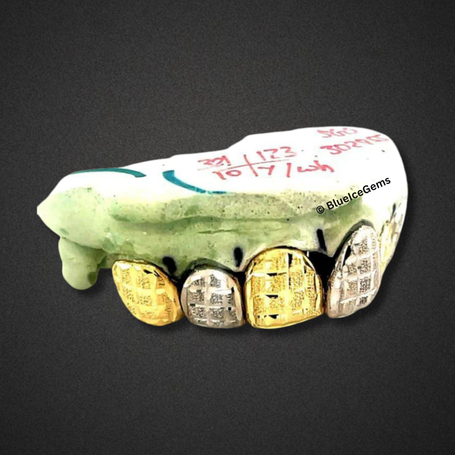 Checker Frost Two‑Tone Grillz