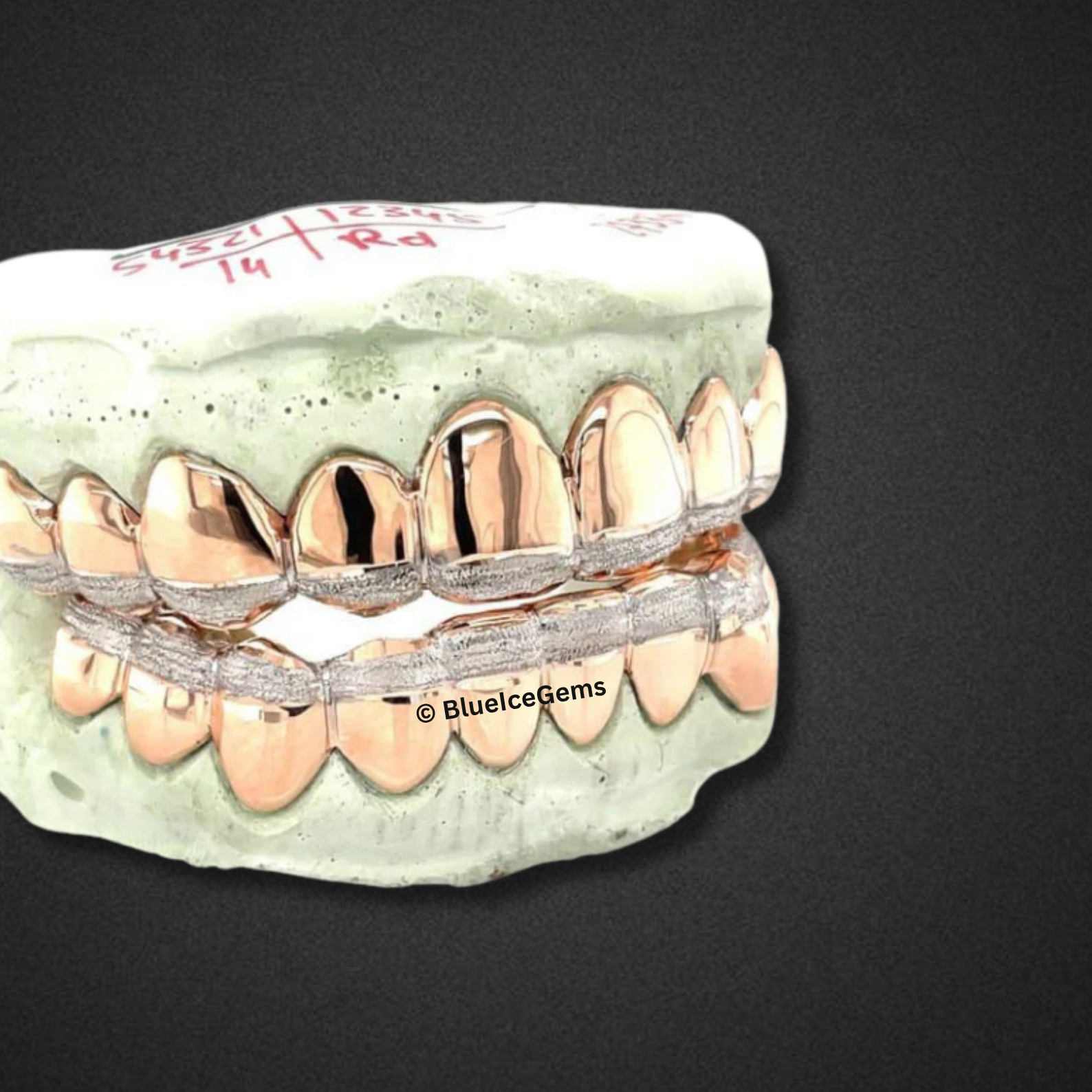Rose Rail Solid Set Grillz