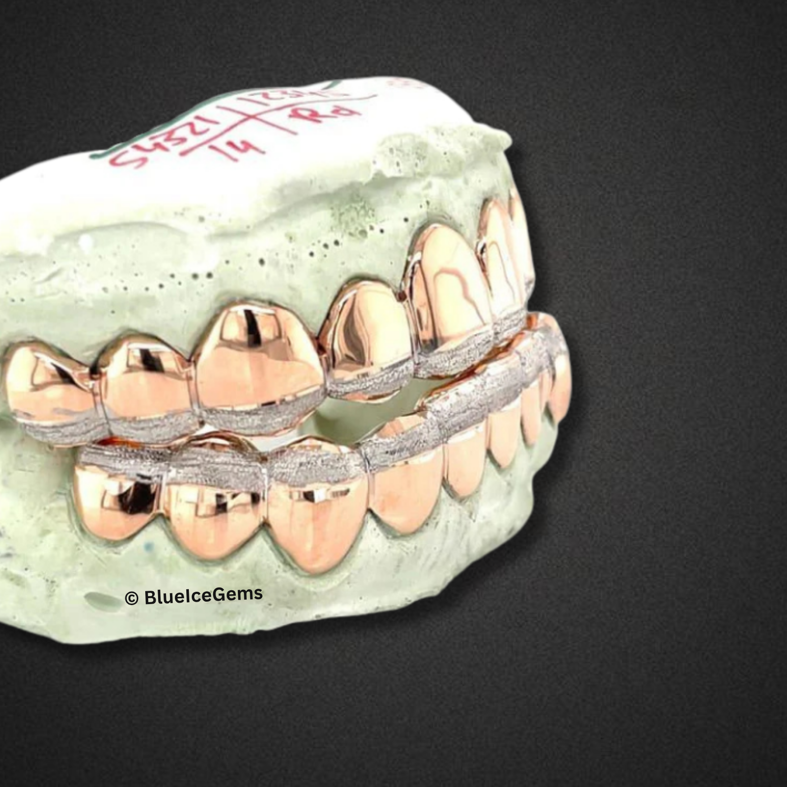 Rose Rail Solid Set Grillz