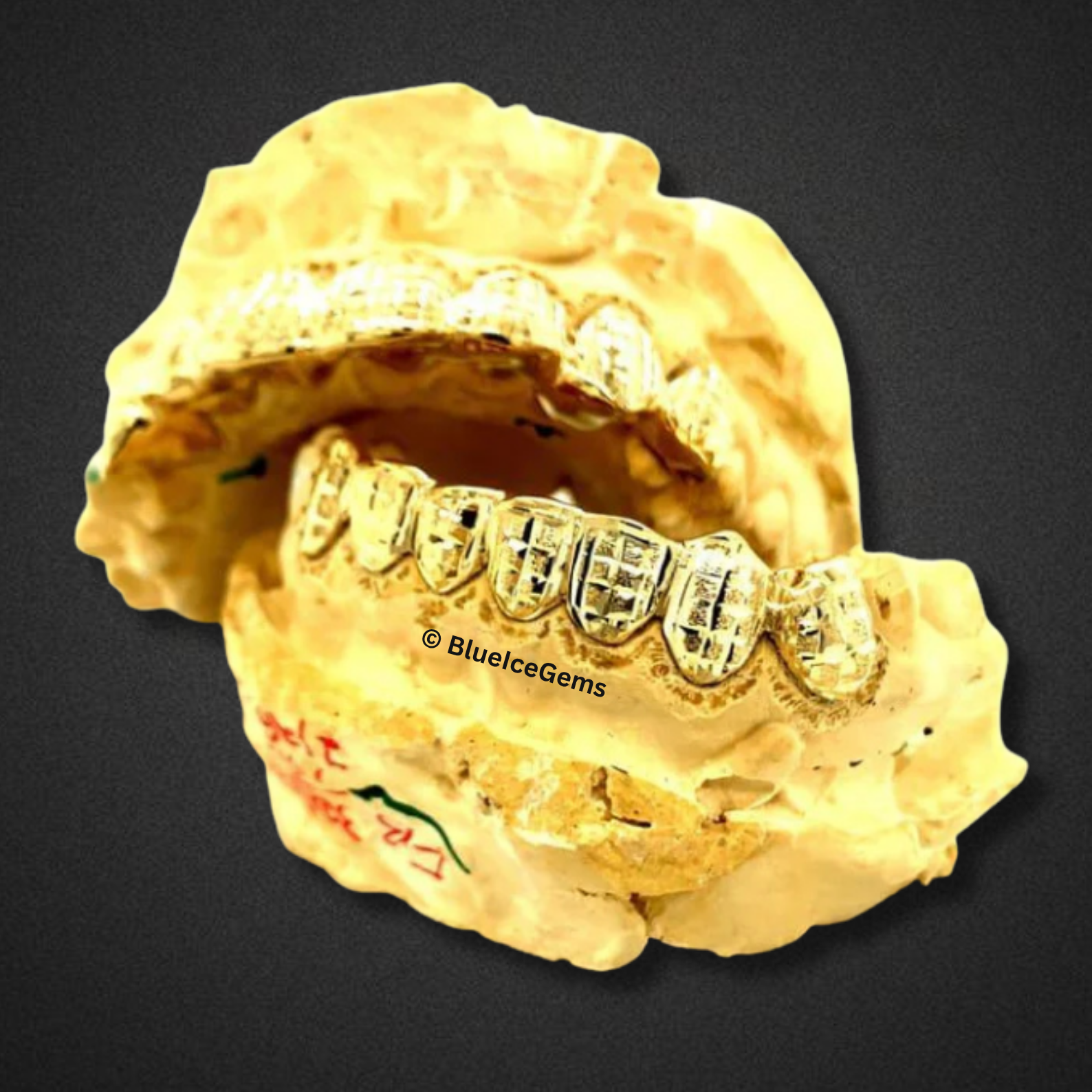 Gold Basketweave Custom Grillz