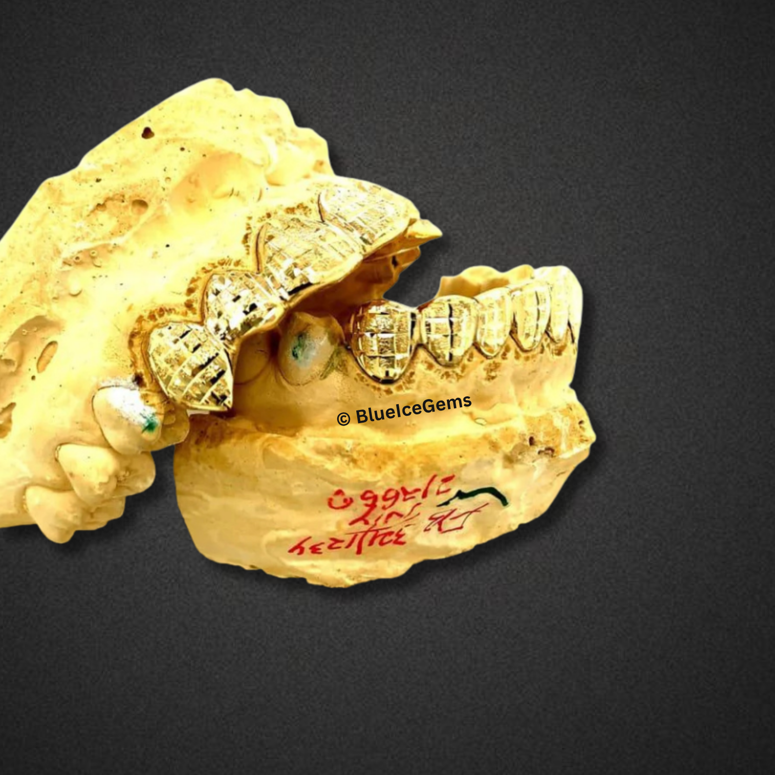 Gold Basketweave Custom Grillz