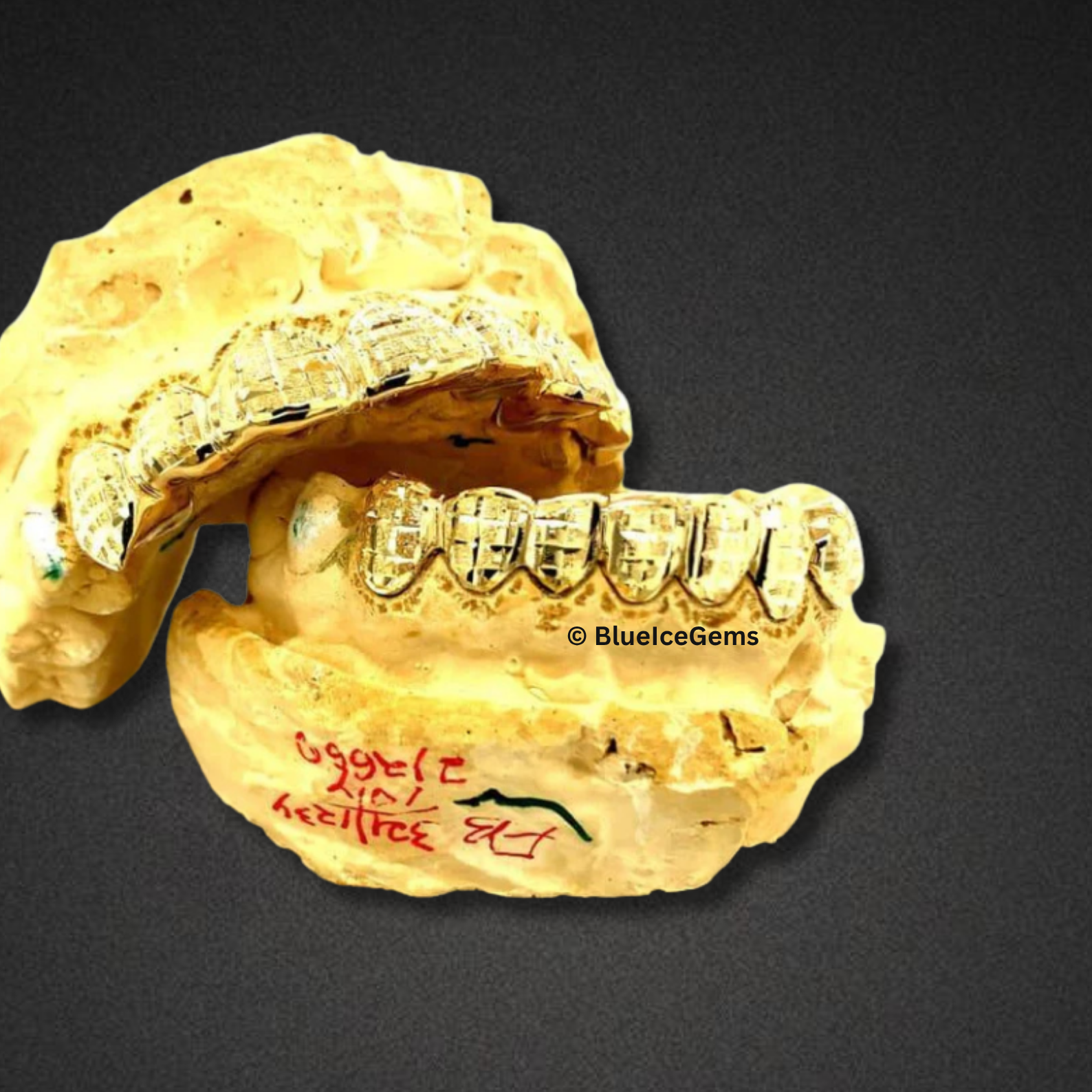 Gold Basketweave Custom Grillz