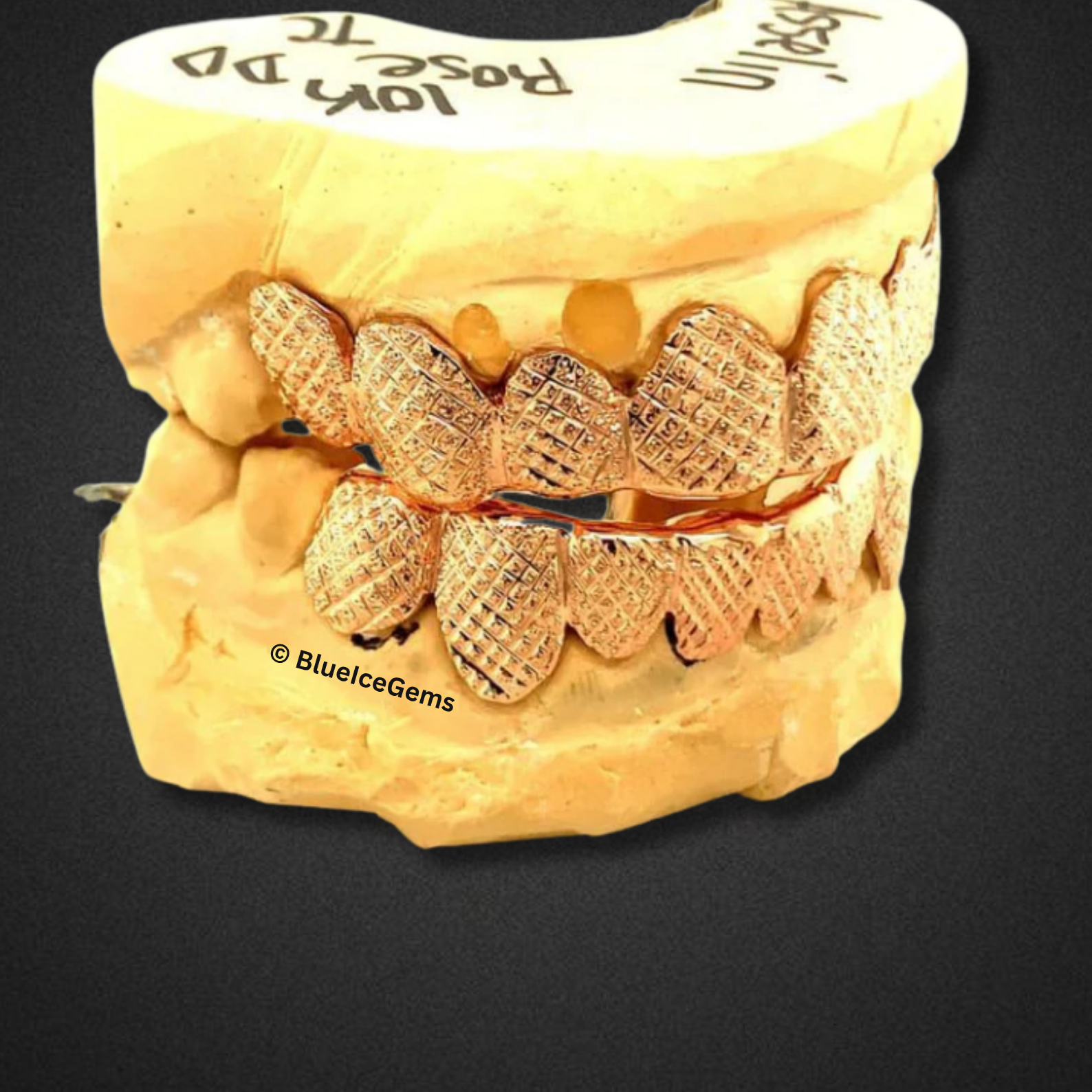 Rose Gold Pinecone Engraved Grillz