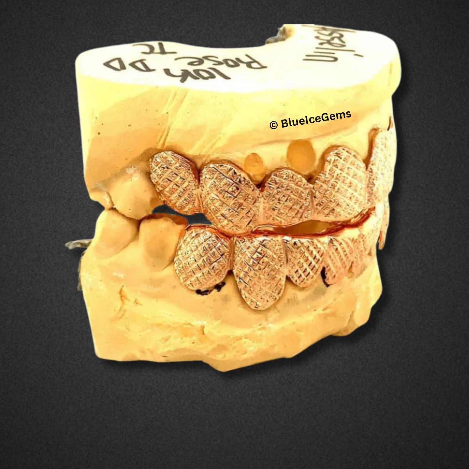 Rose Gold Pinecone Engraved Grillz