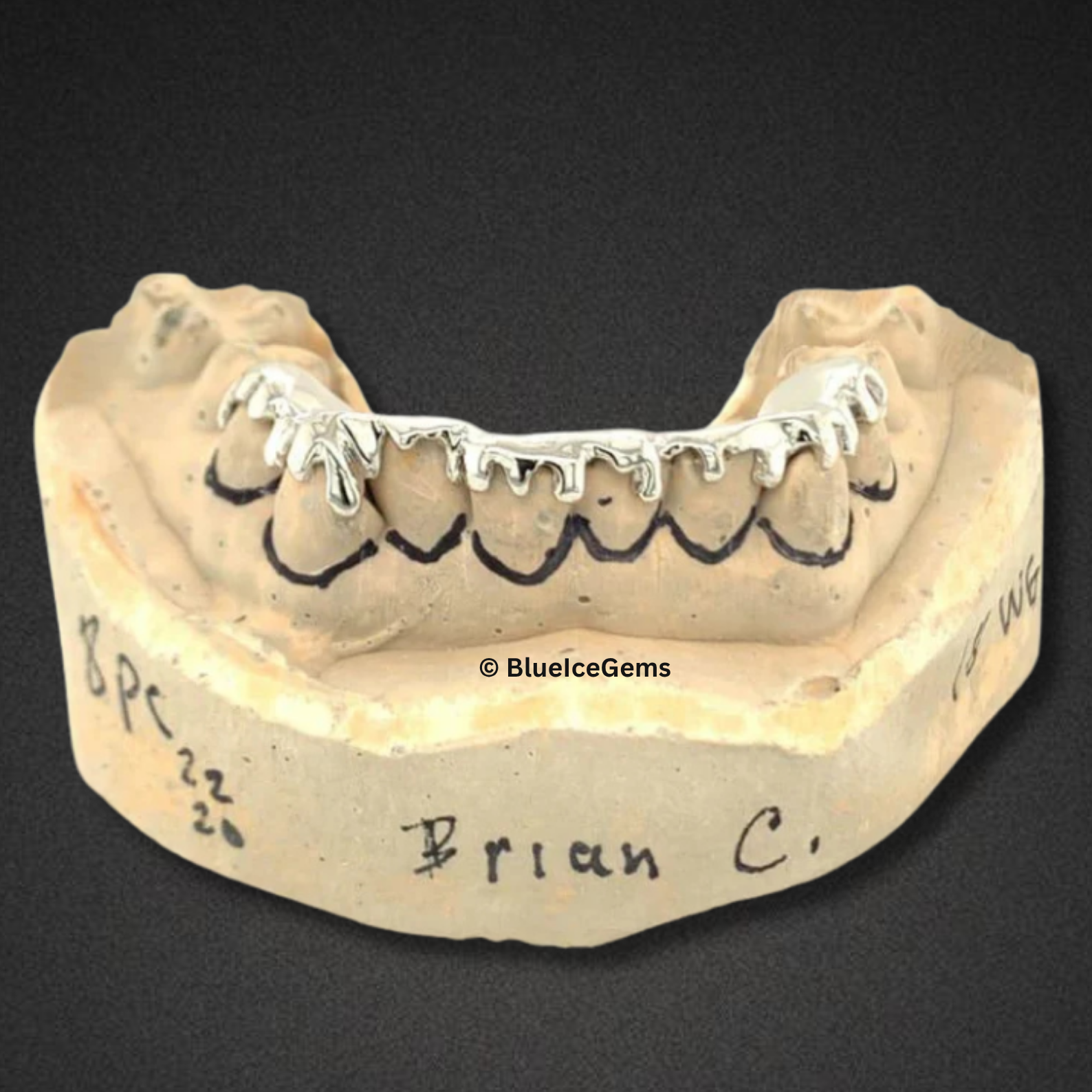 White Gold Drip Outline Grillz