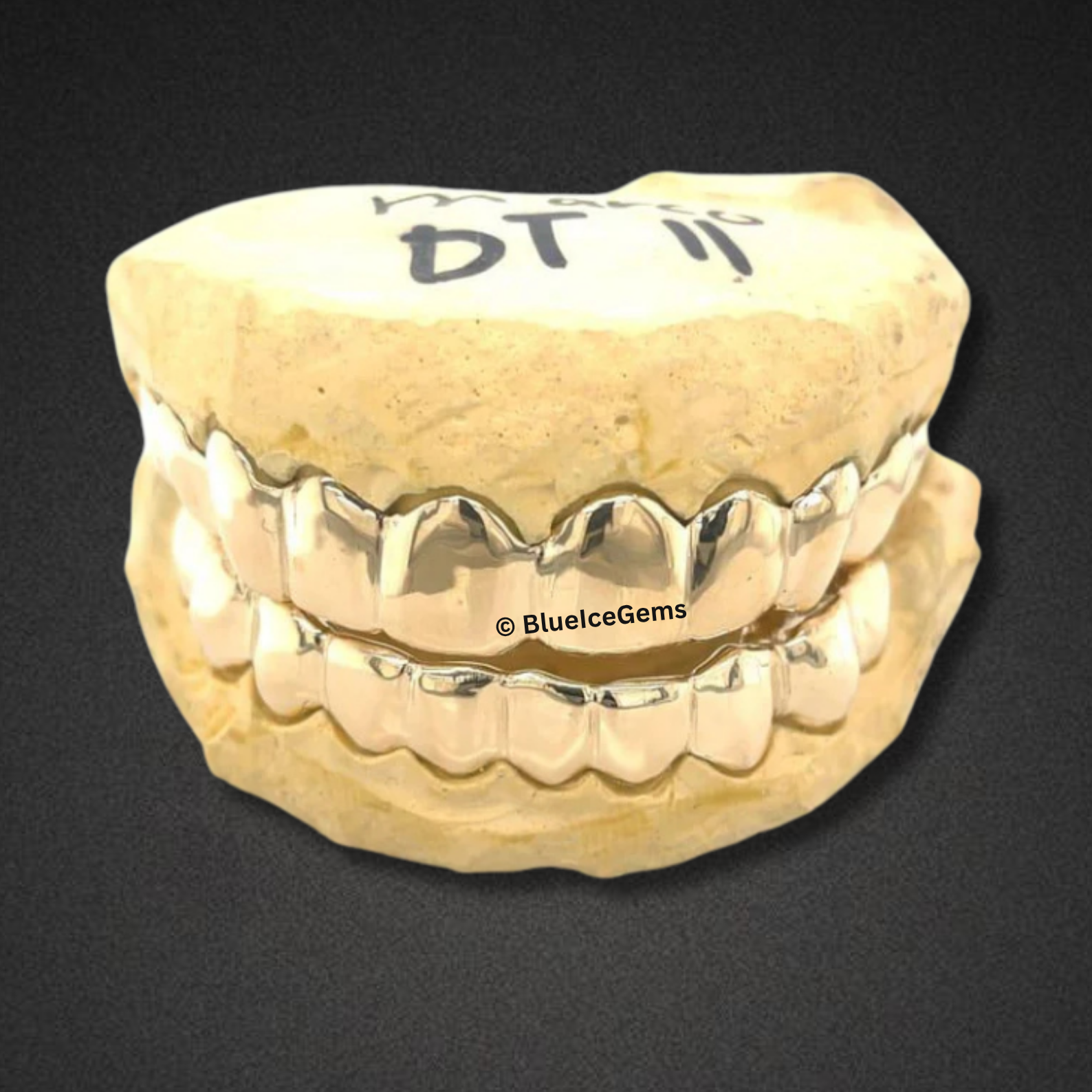 Rose Gold Boss Full Set Grillz