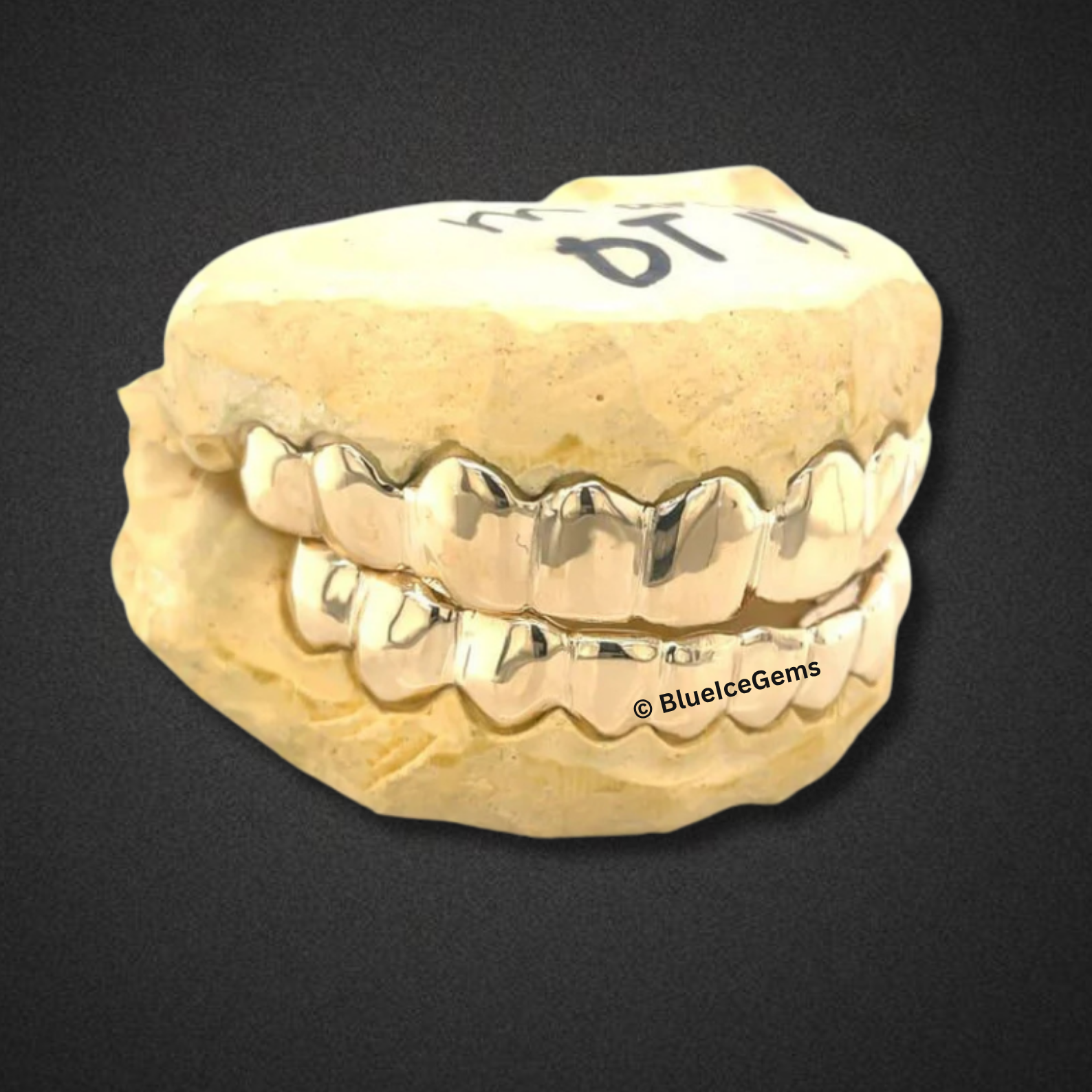 Rose Gold Boss Full Set Grillz