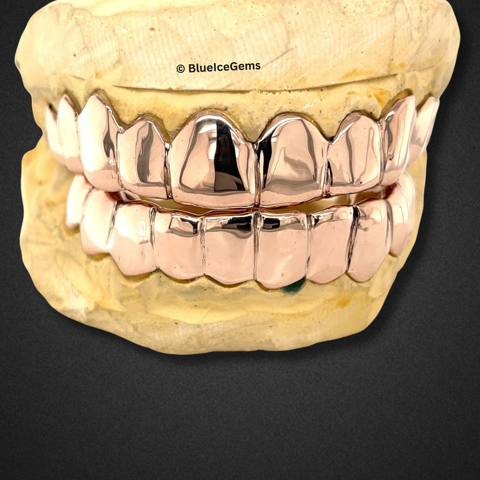 Rose Gold Boss Full Set Grillz