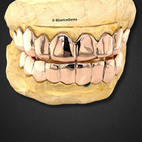 Rose Gold Boss Full Set Grillz