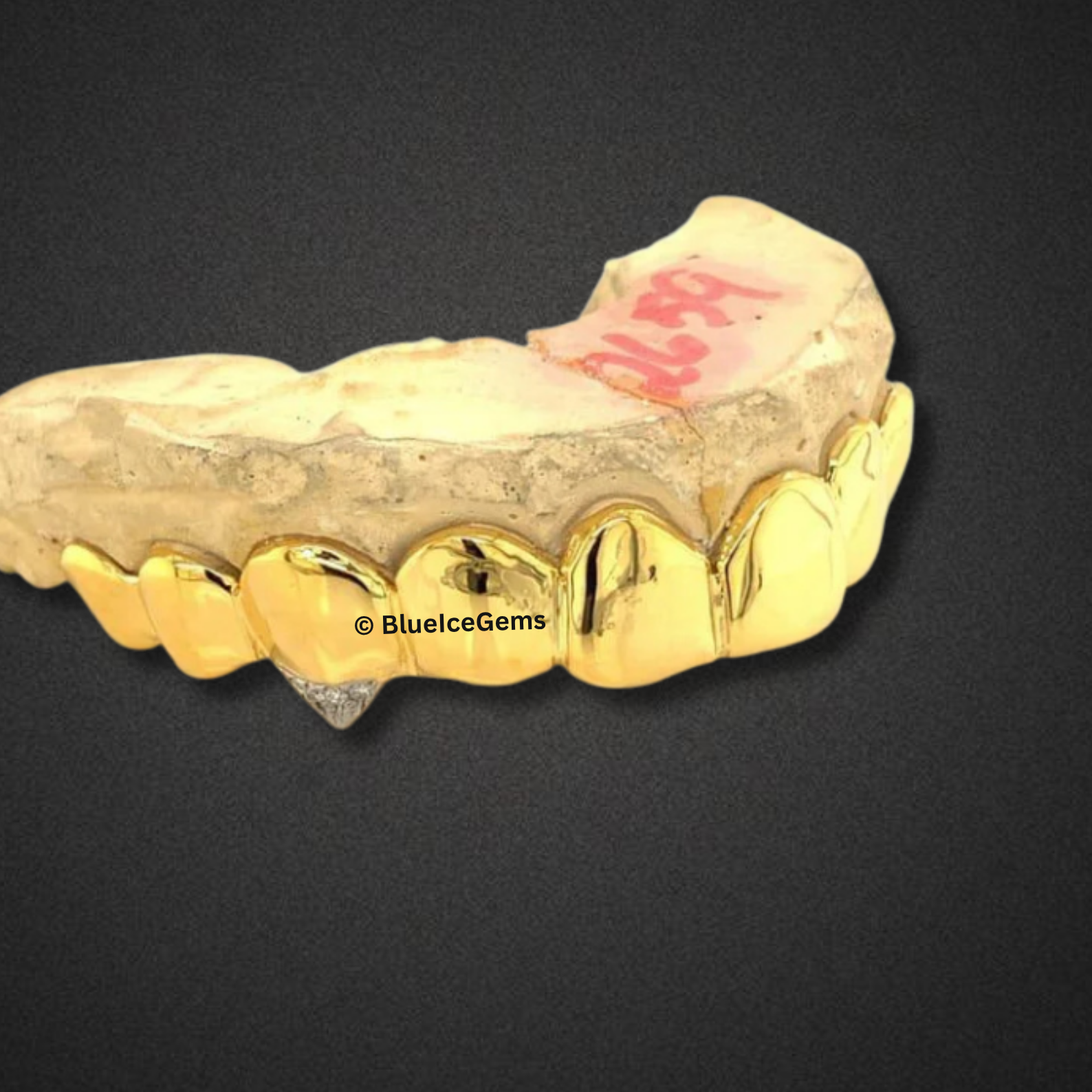 Solid 8-Tooth Gold Grillz