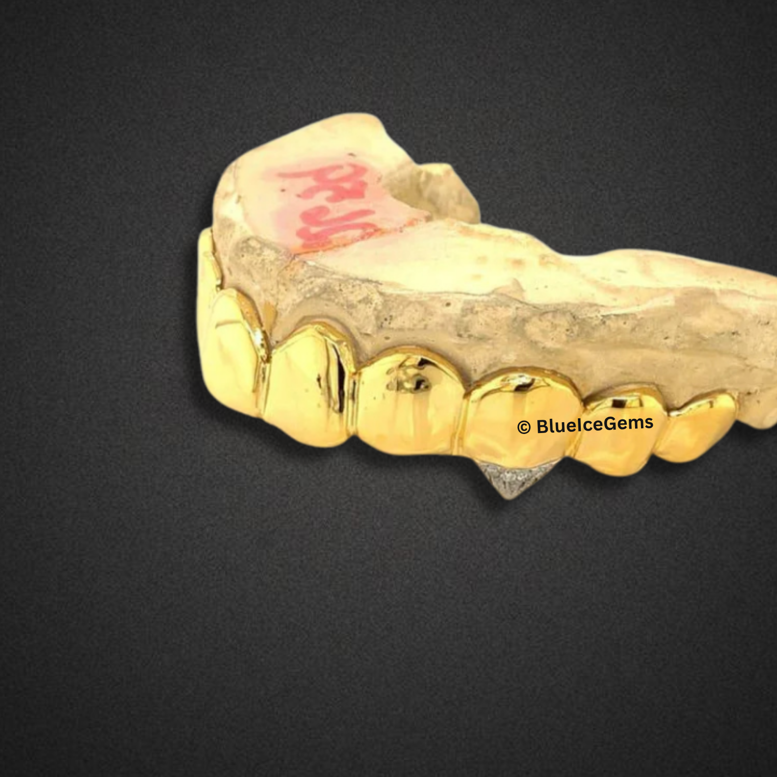 Solid 8-Tooth Gold Grillz