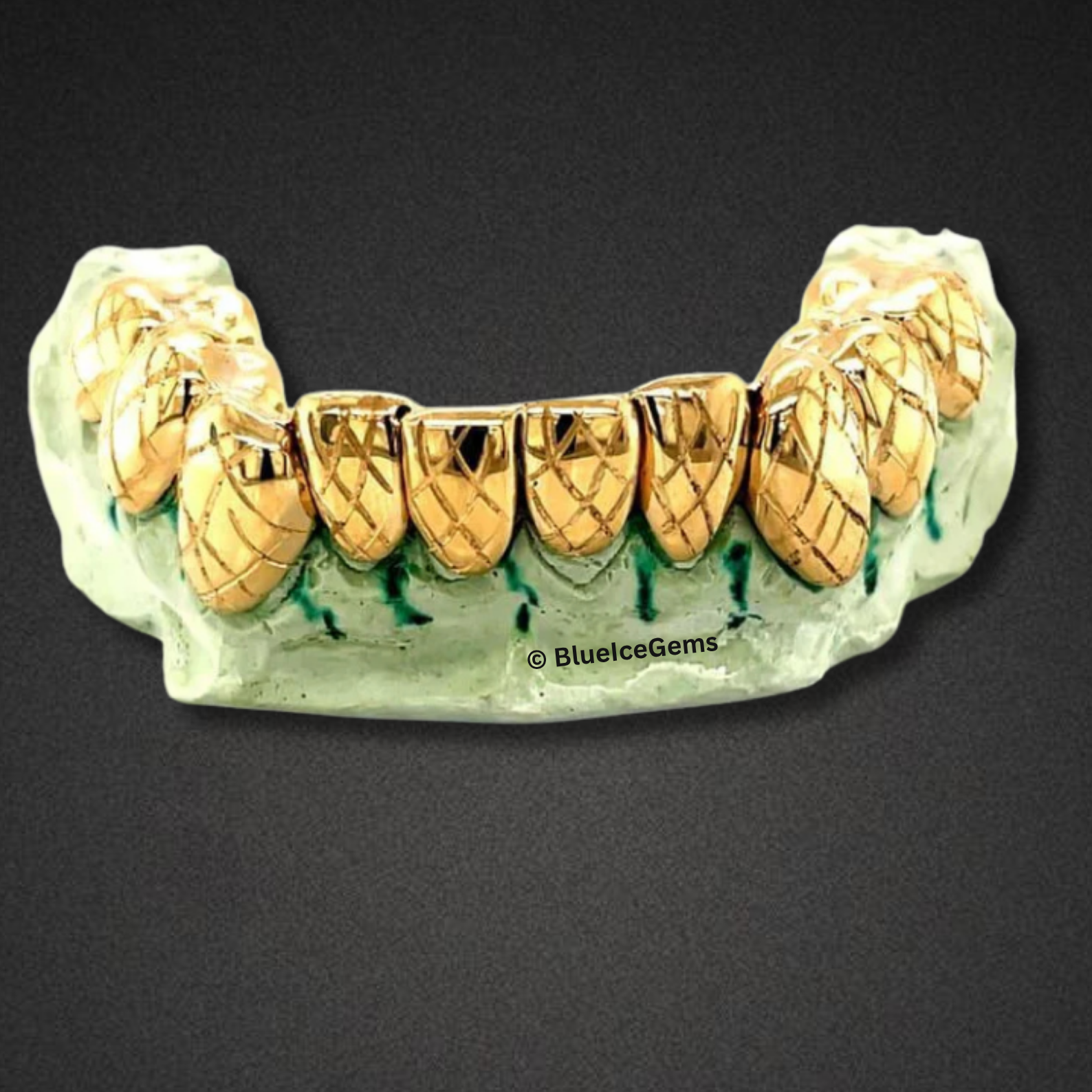 Crosshatched Diamond-Cut Gold Grillz