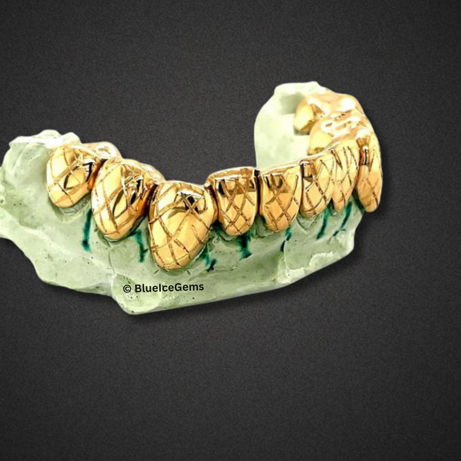 Crosshatched Diamond-Cut Gold Grillz