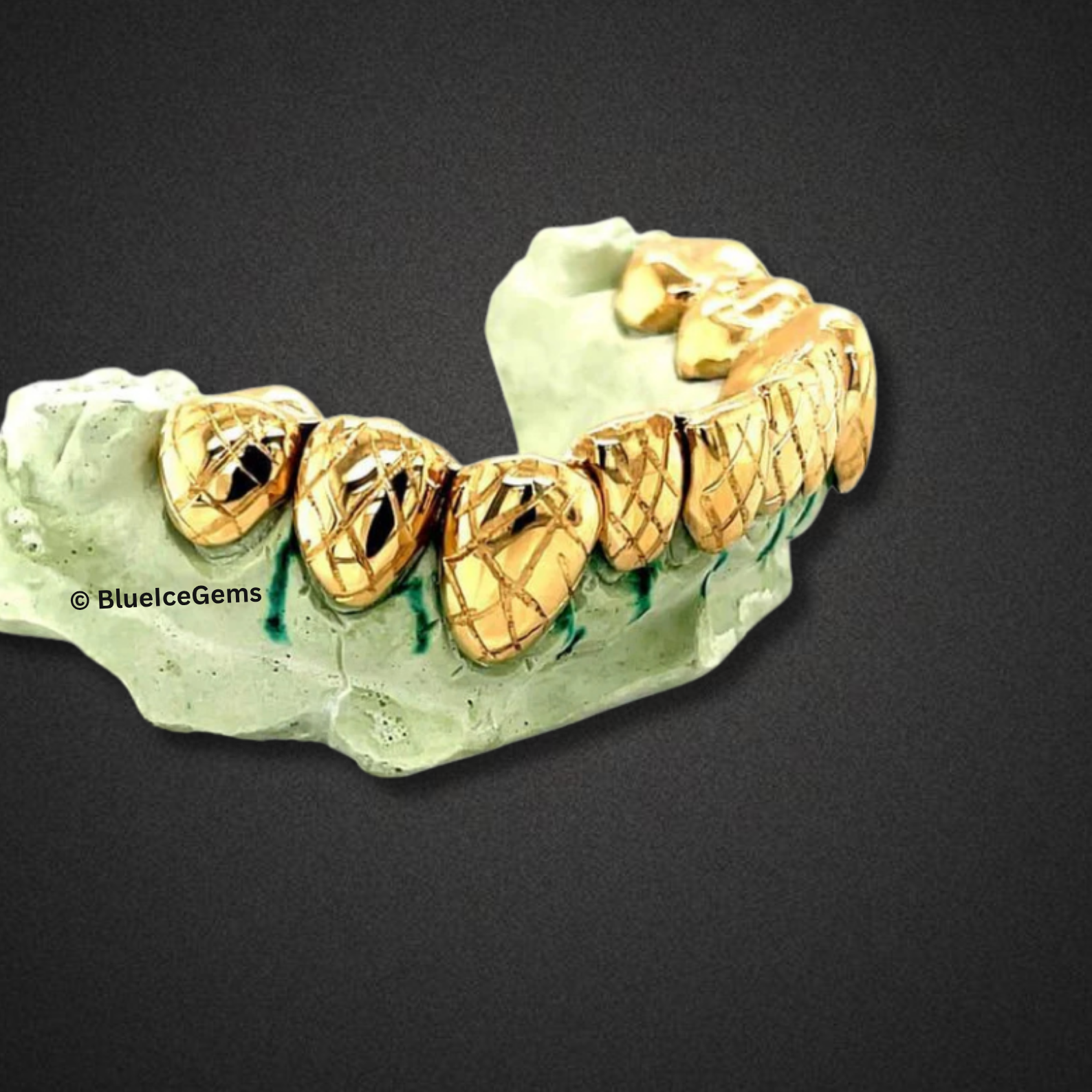 Crosshatched Diamond-Cut Gold Grillz