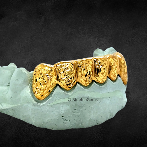 The "Golden Nugget" Textured Grillz